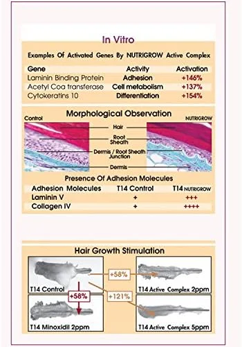 سرم ضد ریزش مو و رشد سریعتر مو نوتری گرو 180 میلی لیتر: 830167 سرم ضد ریزش مو و رشد سریعتر مو نوتری گرو 180 میلی لیتر: 830167