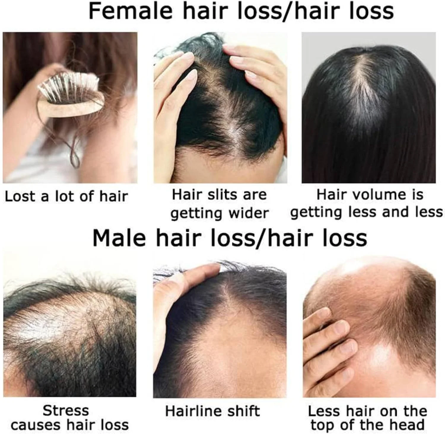 محلول تغذیه مو زنجبیل Natural Essence، سرم رشد مجدد مو، مایع درمان ریزش مو با عصاره زنجبیل و جینسینگ برای تقویت ریشه مو و موهای نازک (بسته 3 عددی) محلول تغذیه مو زنجبیل Natural Essence، سرم رشد مجدد مو، مایع درمان ریزش مو با عصاره زنجبیل و جینسینگ برای تقویت ریشه مو و موهای نازک (بسته 3 عددی)