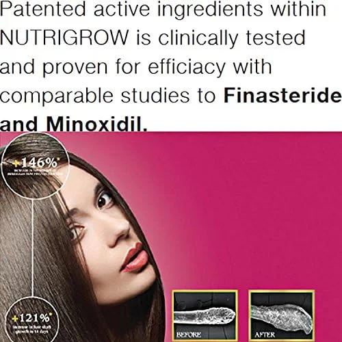 سرم ضد ریزش مو و رشد سریعتر مو نوتری گرو 180 میلی لیتر: 830167 سرم ضد ریزش مو و رشد سریعتر مو نوتری گرو 180 میلی لیتر: 830167