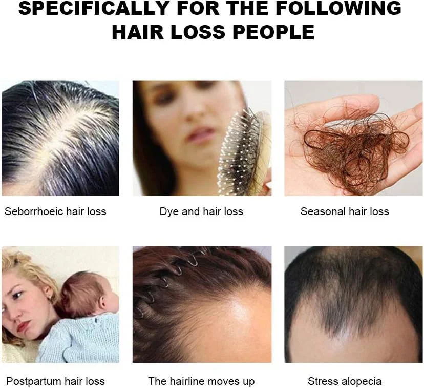 اسپری رشد مو، روغن سرم رشد سریع مو، ضد ریزش مو، مراقبت مغذی از رشد مو، درمان رشد مجدد مو با مواد طبیعی برای رشد مو، ترمیم فولیکول های مو، مناسب برای انواع مو 50 میلی لیتر