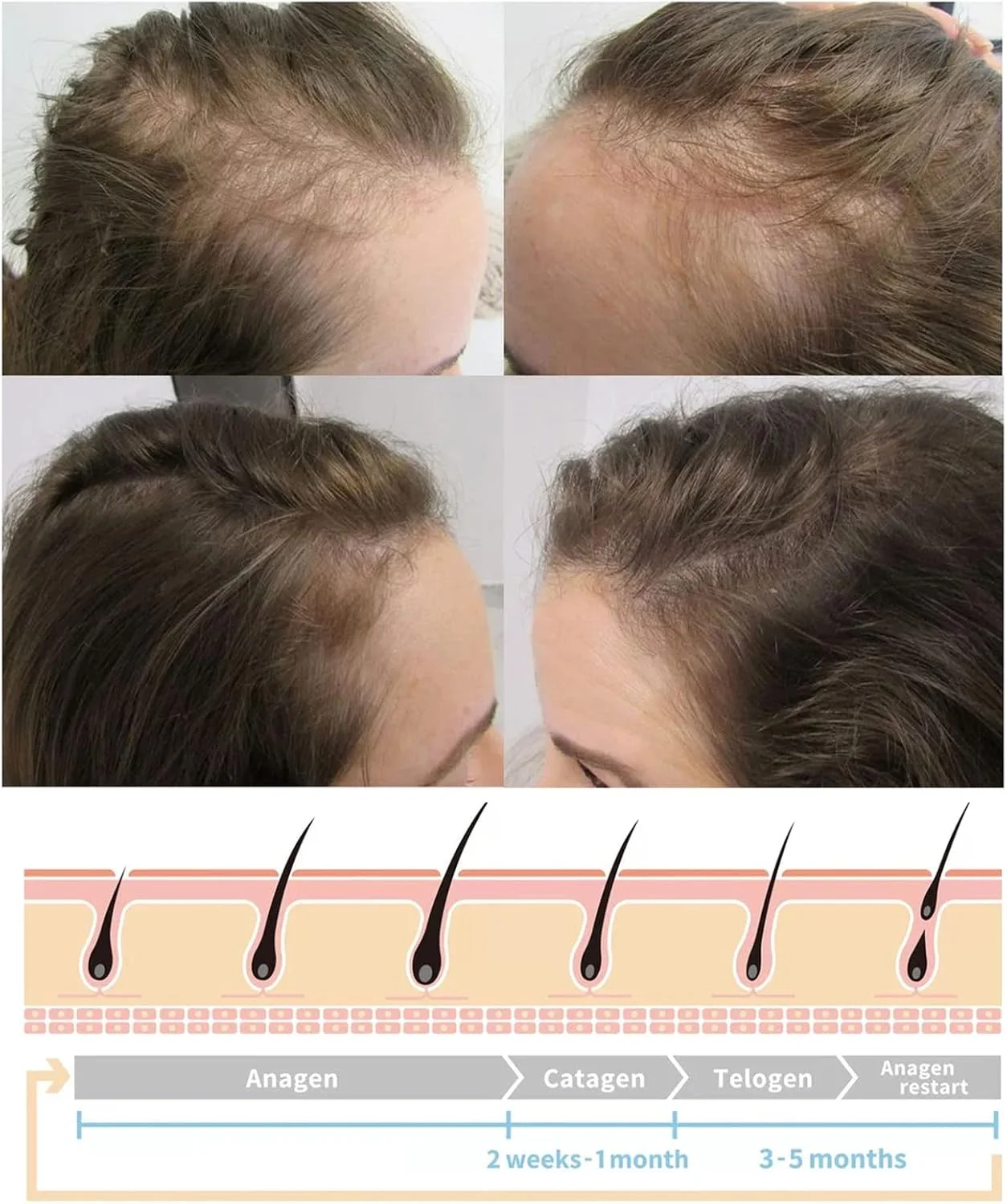 اسپری مغذی رشد مو، سرم ترمیم کننده رشد مو، محلول تقویت کننده ریشه مو، روغن رشد مو، اسپری مرطوب کننده طبیعی مو، تغذیه کننده ریشه