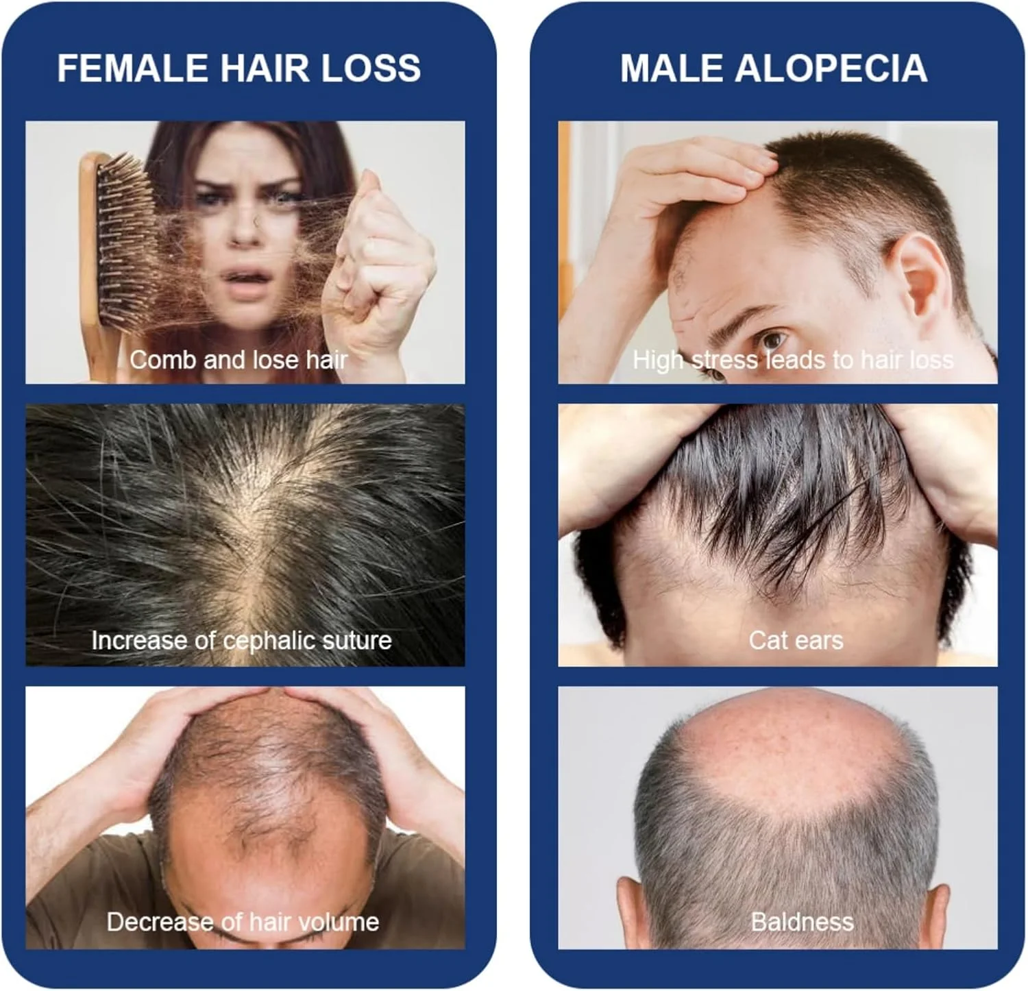 سرم رشد مو نوولان 30 میلی لیتر - اسپری ضخیم کننده مو مردانه برای رشد مجدد مو، درمان ترمیم عمیق فولیکول های مو، فرمول مغذی برای جلوگیری از ریزش مو، بازیابی رطوبت و استحکام، مراقبت از پوست سر