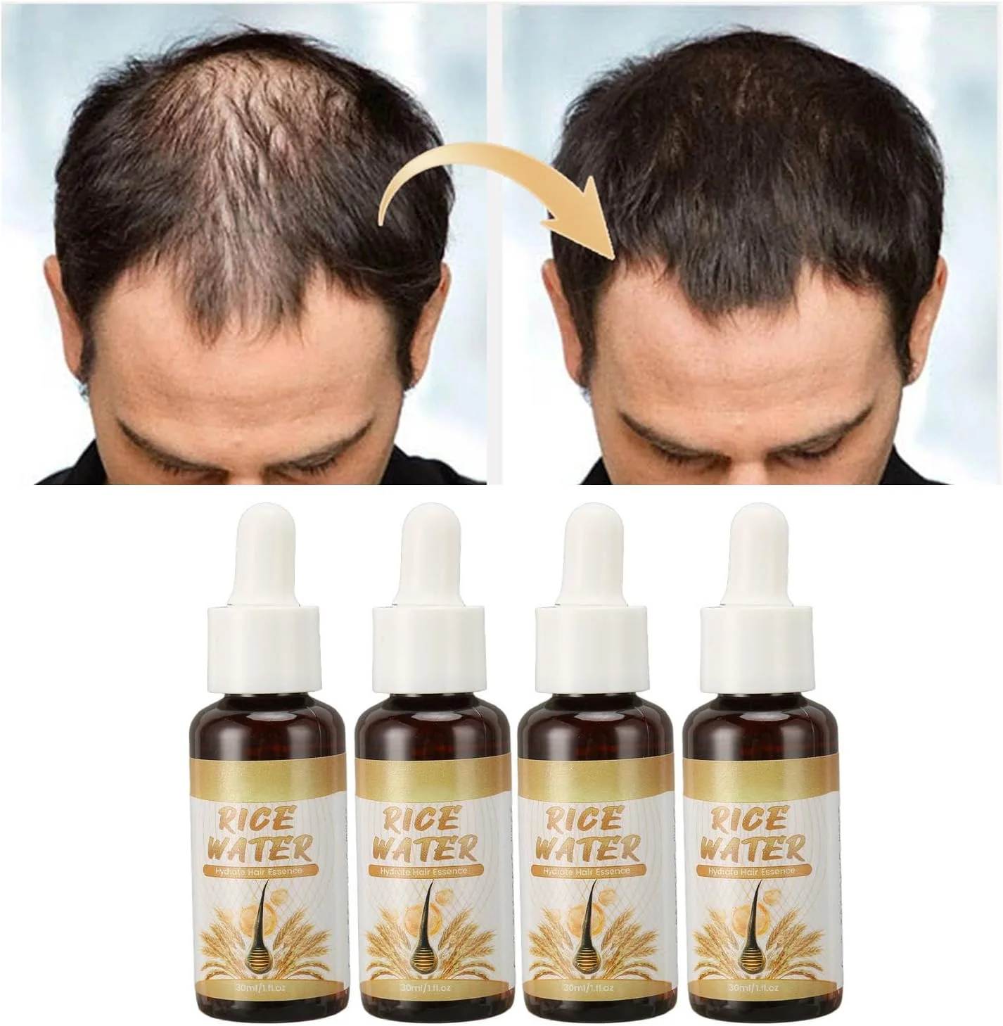 محلول رشد مو 30 میلی لیتری، 4 عددی، کاهش موخوره، تغذیه فولیکول ها برای موهای ضخیم تر، مرطوب کننده و آبرسان، رشد مجدد مو