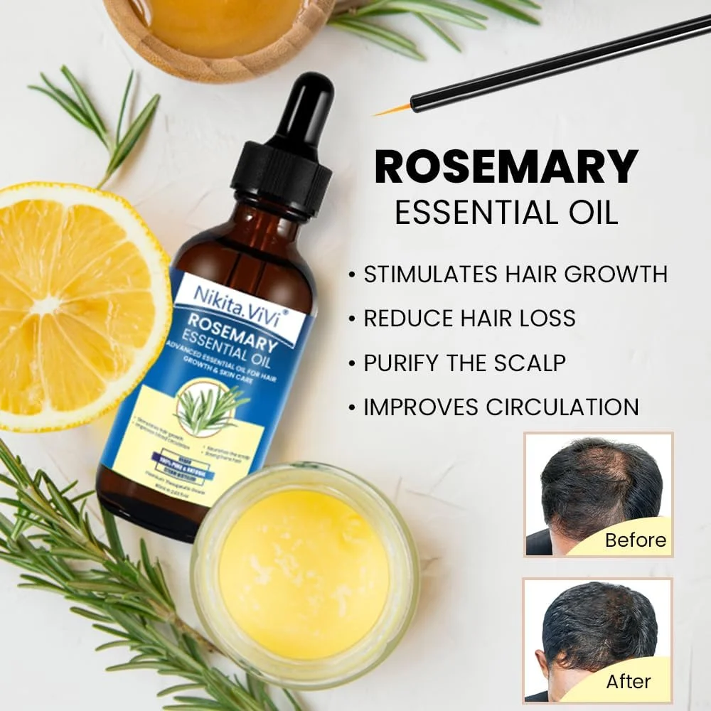 روغن رزماری نیکیتا ویوی برای رشد مو 60 میلی لیتر، 100% خالص طبیعی و ارگانیک، تقویت کننده و ترمیم کننده موهای خشک و آسیب دیده، سرم درمان پوست سر برای زنان و مردان روغن رزماری نیکیتا ویوی برای رشد مو 60 میلی لیتر، 100% خالص طبیعی و ارگانیک، تقویت کننده و ترمیم کننده موهای خشک و آسیب دیده، سرم درمان پوست سر برای زنان و مردان