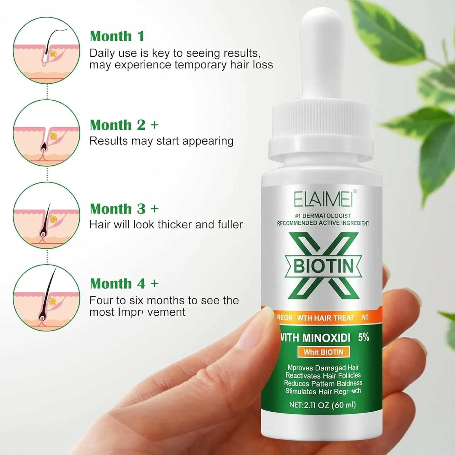 سرم رشد مو NIKITA.VIVI حاوی 5% ماینوکسیدیل و بیوتین 60 میلی لیتر، سرم درمان رشد مجدد مو برای موهای آسیب دیده، فعال کننده مجدد فولیکول های مو، کاهش دهنده طاسی الگویی، محرک روغن رشد مو سرم رشد مو NIKITA.VIVI حاوی 5% ماینوکسیدیل و بیوتین 60 میلی لیتر، سرم درمان رشد مجدد مو برای موهای آسیب دیده، فعال کننده مجدد فولیکول های مو، کاهش دهنده طاسی الگویی، محرک روغن رشد مو