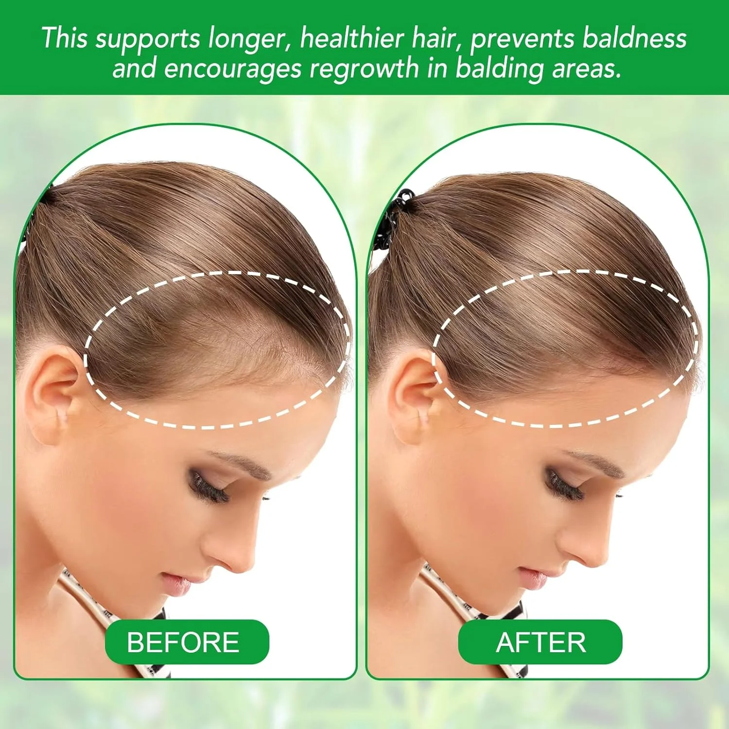 روغن رزماری NIKITA.VIVI برای رشد مو به همراه غلتک میکرونیدل و ماساژور پوست سر 30 میلی لیتر، روغن ضروری رزماری 100% ارگانیک پرس سرد برای روغن سرم رشد مو، ابرو، مژه و ریش روغن رزماری NIKITA.VIVI برای رشد مو به همراه غلتک میکرونیدل و ماساژور پوست سر 30 میلی لیتر، روغن ضروری رزماری 100% ارگانیک پرس سرد برای روغن سرم رشد مو، ابرو، مژه و ریش