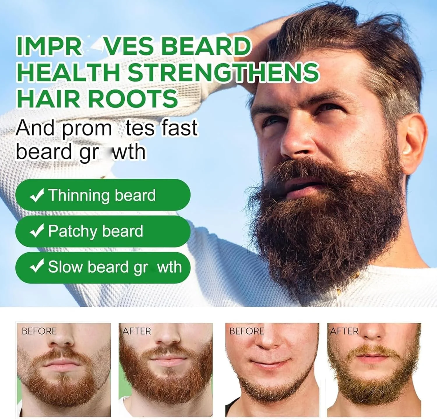 سرم رشد مو NIKITA.VIVI حاوی 5% ماینوکسیدیل و بیوتین 60 میلی لیتر، سرم درمان رشد مجدد مو برای موهای آسیب دیده، فعال کننده مجدد فولیکول های مو، کاهش دهنده طاسی الگویی، محرک روغن رشد مو سرم رشد مو NIKITA.VIVI حاوی 5% ماینوکسیدیل و بیوتین 60 میلی لیتر، سرم درمان رشد مجدد مو برای موهای آسیب دیده، فعال کننده مجدد فولیکول های مو، کاهش دهنده طاسی الگویی، محرک روغن رشد مو