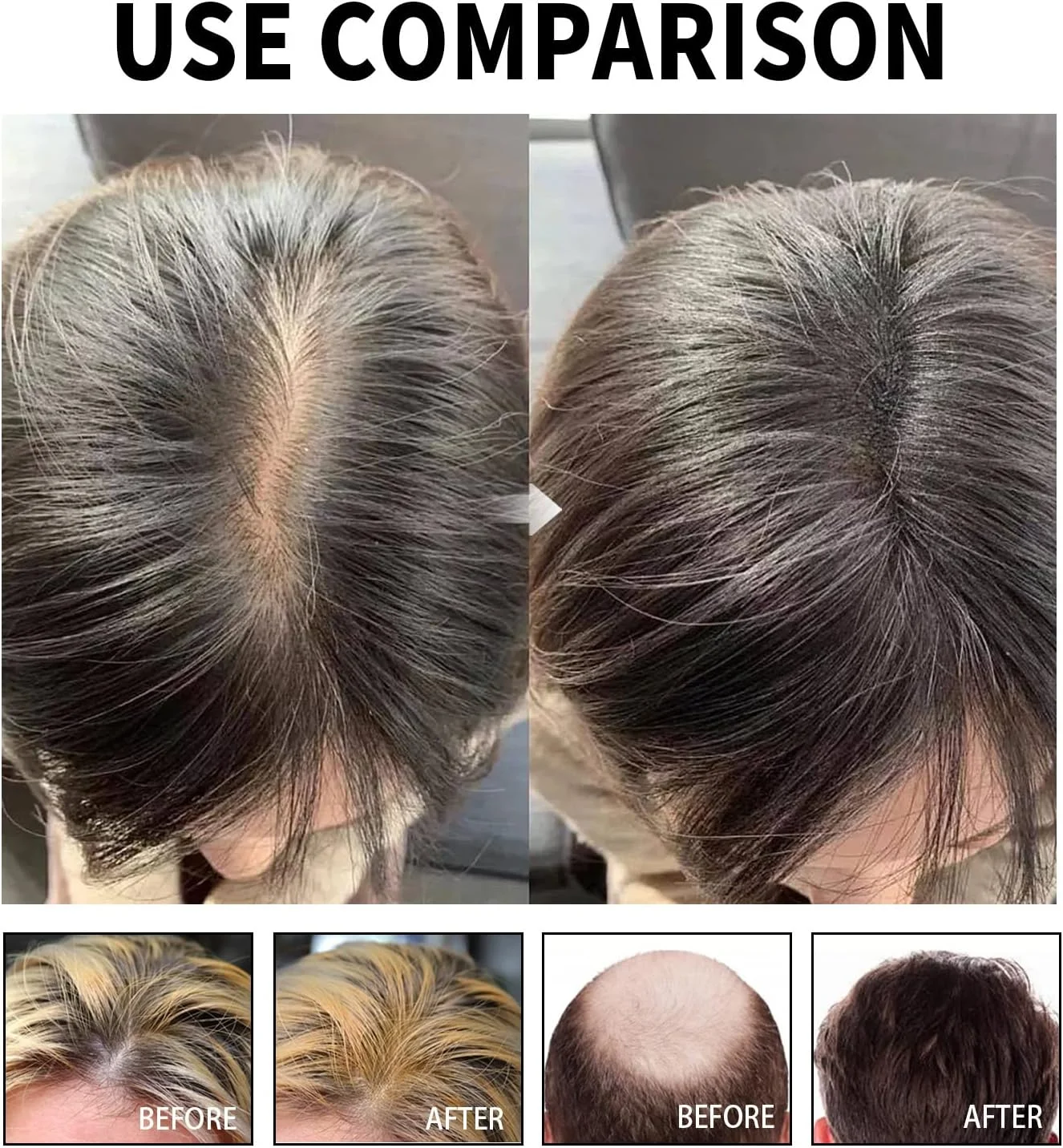 سرم محلول ضد ریزش مو پپیسکی 60 میلی لیتر، طبیعی، جلوگیری از ریزش مو، تحریک کننده پوست سر سرم محلول ضد ریزش مو پپیسکی 60 میلی لیتر، طبیعی، جلوگیری از ریزش مو، تحریک کننده پوست سر