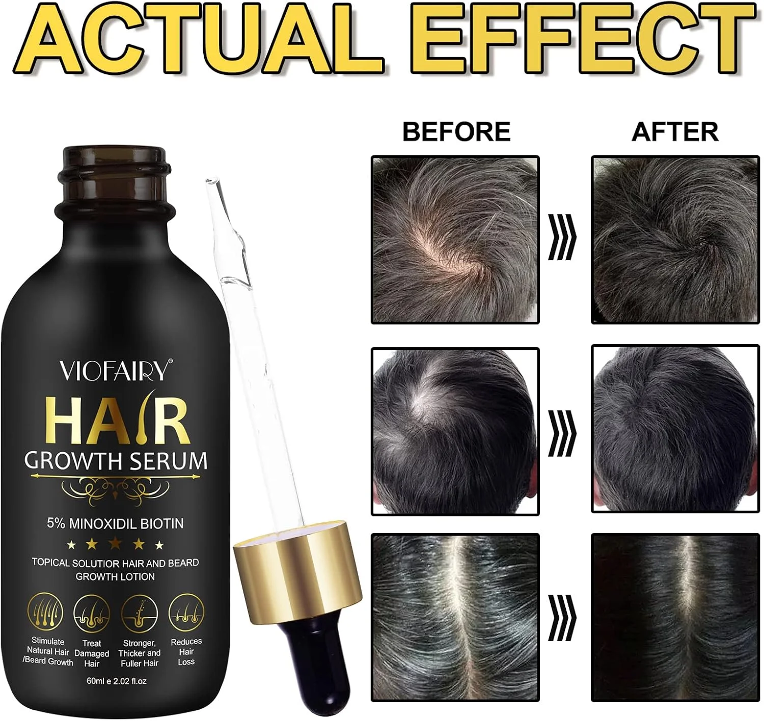 روغن رشد مو PEFAMNE حاوی 5% ماینوکسیدیل برای مردان و زنان، سرم بیوتین، درمان رشد مجدد مو برای جلوگیری از ریزش موی سر، طبیعی، برای موهای ضخیم تر، بلندتر، پرپشت تر و سالم تر 60 میلی لیتر