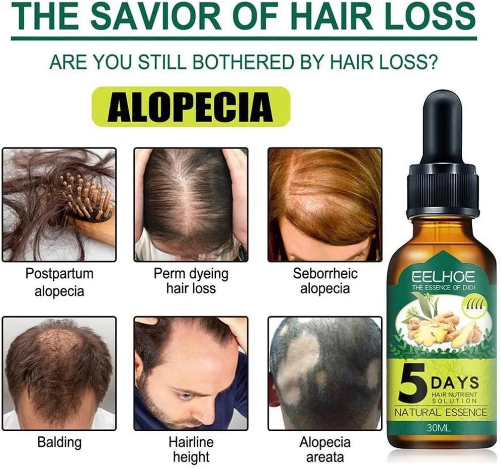 سرم روغن زنجبیل برای رشد مو، جلوگیری از طاسی، جذب خوب، رشد سریع، سرم 30 میلی لیتری، ابزارهای مغذی موی زنانه