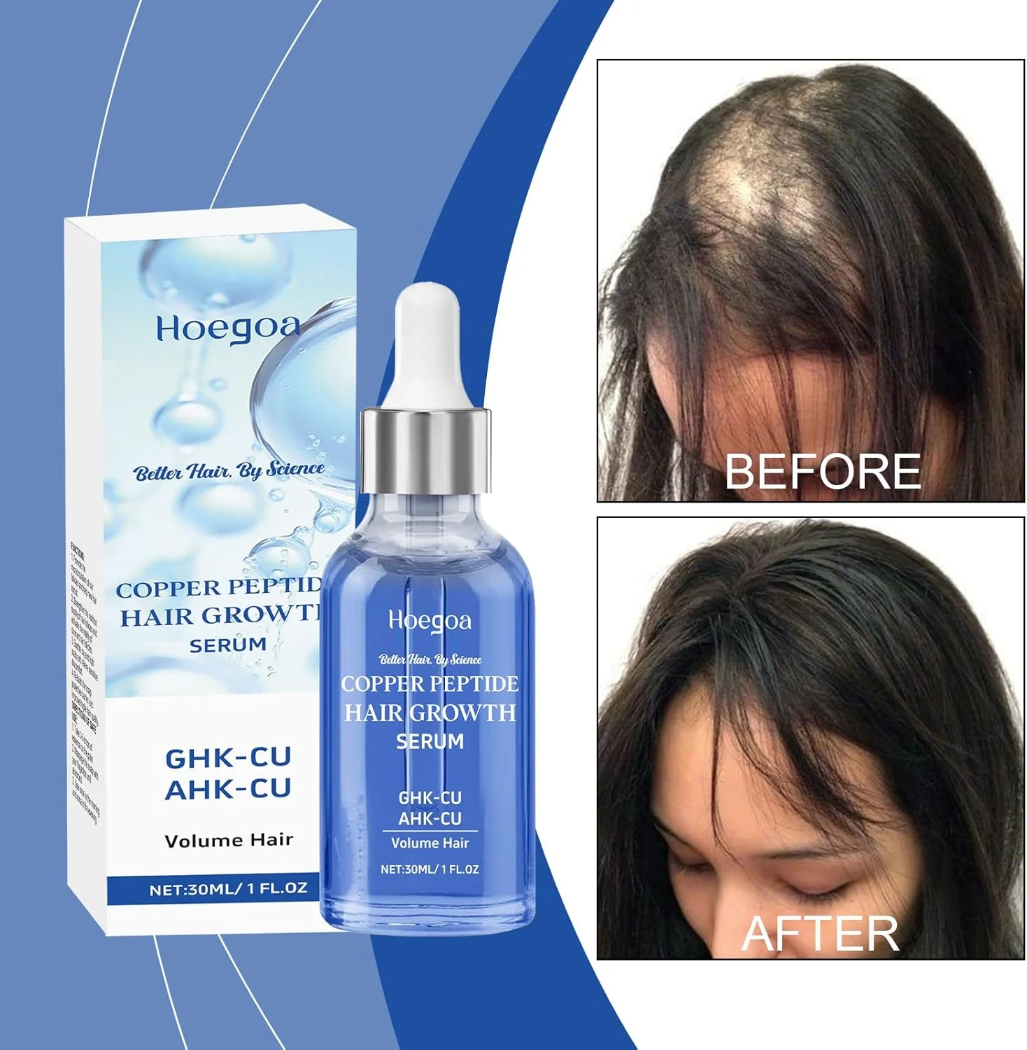 سرم پپتید مس 10% GHK-CU 5% AHK-CU درمان قوی رشد مو، تحریک کننده فولیکول ها، کاهش دهنده نازکی، ضخیم کننده مو، بهبود سلامت پوست سر برای موهای پرپشت تر و قوی تر در طول زمان