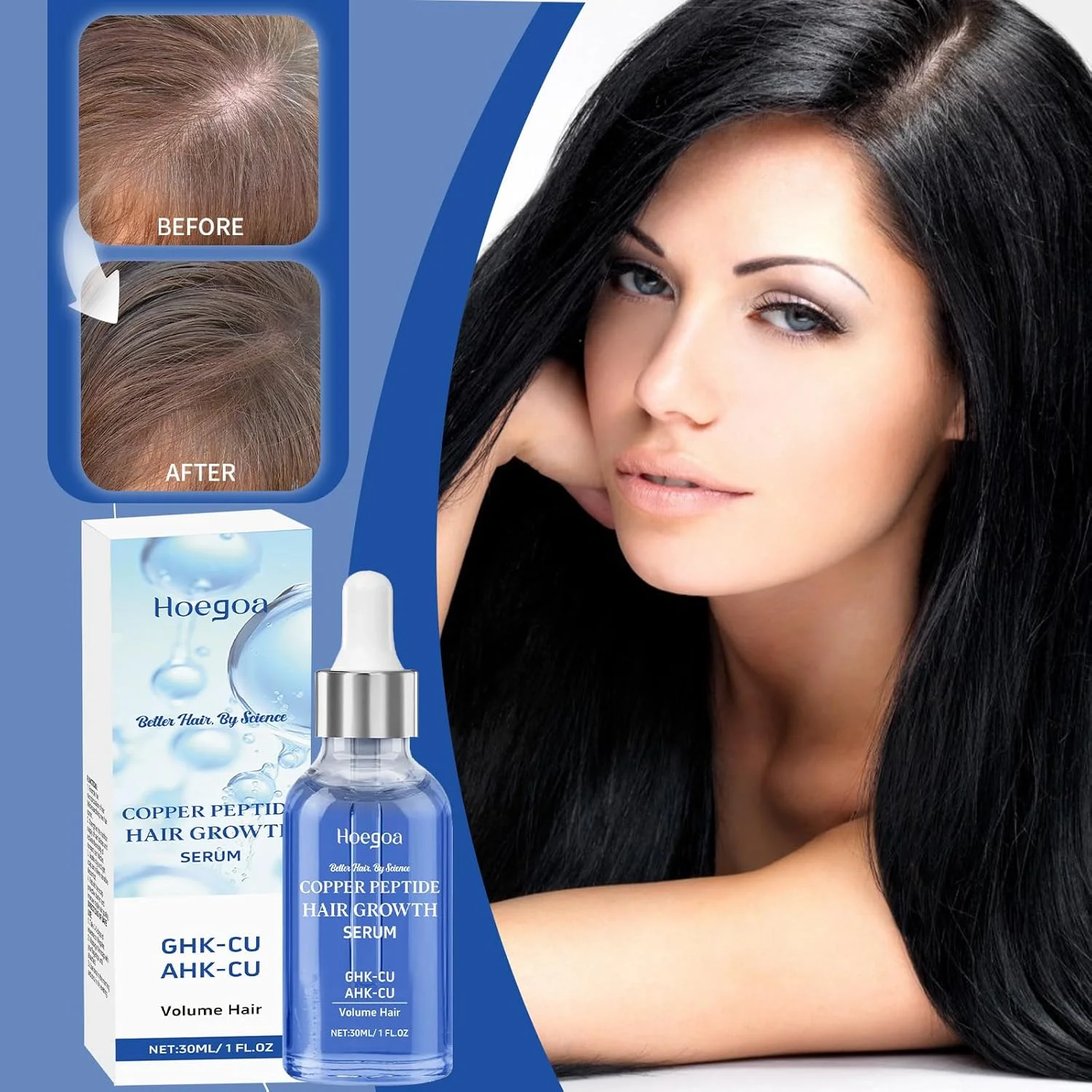 سرم پپتید مس 10% GHK-CU 5% AHK-CU درمان قوی رشد مو، تحریک کننده فولیکول ها، کاهش دهنده نازکی، ضخیم کننده مو، بهبود سلامت پوست سر برای موهای پرپشت تر و قوی تر در طول زمان