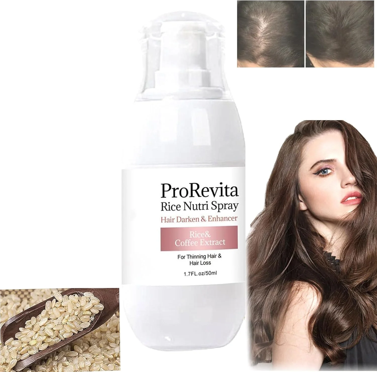 زپتا H-Regrow 2.0 - اسپری و سرم مغذی برنج ProRevita برای موهای نازک و ریزش مو، 3 عدد زپتا H-Regrow 2.0 - اسپری و سرم مغذی برنج ProRevita برای موهای نازک و ریزش مو، 3 عدد