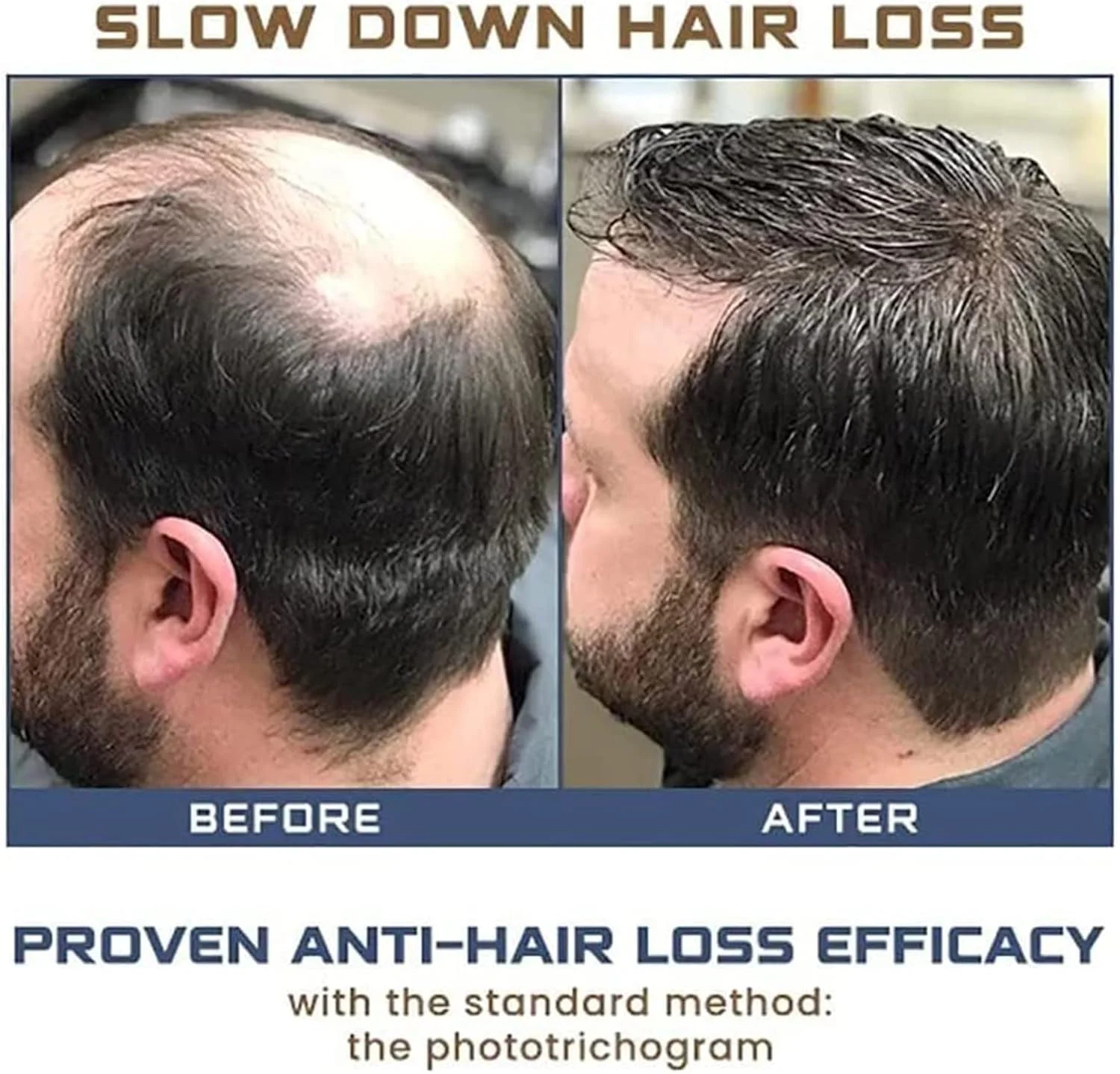 اسپری تقویت کننده مو ZOKU-HGP، سرم رشد مو Polygonum Multiflorums، افزایش تراکم مو، روغن های ضروری رشد مو عصاره زنجبیل برای مردان و زنان (3 عدد)