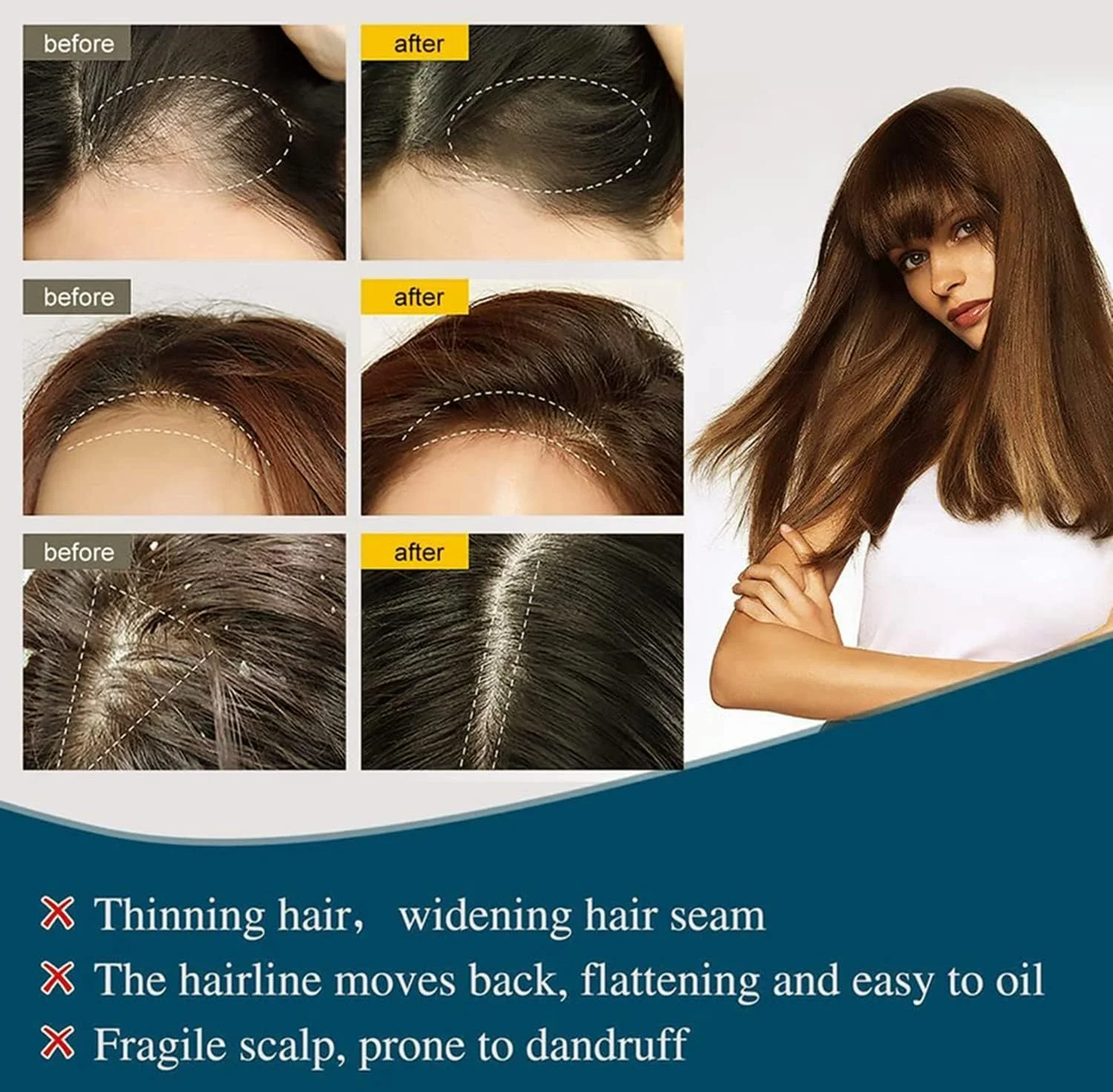 سرم لوسیون آمپول رشد مو Hair-Much، سرم رشد مو، آمپول های درمان سرم ضد ریزش مو، سرم رشد مو Hair-Much (3 جعبه) سرم لوسیون آمپول رشد مو Hair-Much، سرم رشد مو، آمپول های درمان سرم ضد ریزش مو، سرم رشد مو Hair-Much (3 جعبه)