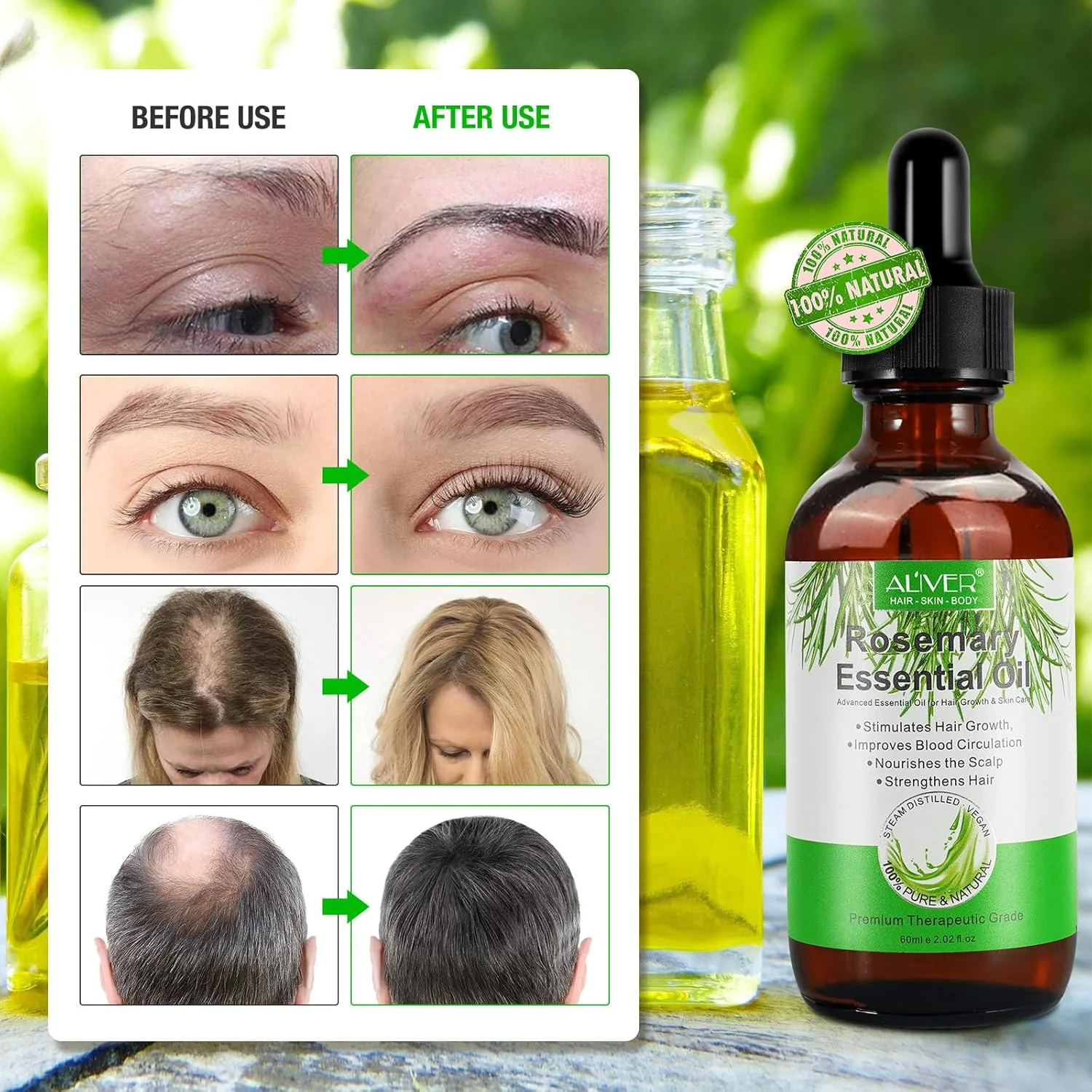 روغن رزماری ALIVER برای رشد مو، درمان ریزش مو، تحریک رشد مو، تقویت مو، تغذیه پوست سر، رفع خارش و خشکی پوست سر، بهبود گردش خون برای آقایان و بانوان روغن رزماری ALIVER برای رشد مو، درمان ریزش مو، تحریک رشد مو، تقویت مو، تغذیه پوست سر، رفع خارش و خشکی پوست سر، بهبود گردش خون برای آقایان و بانوان
