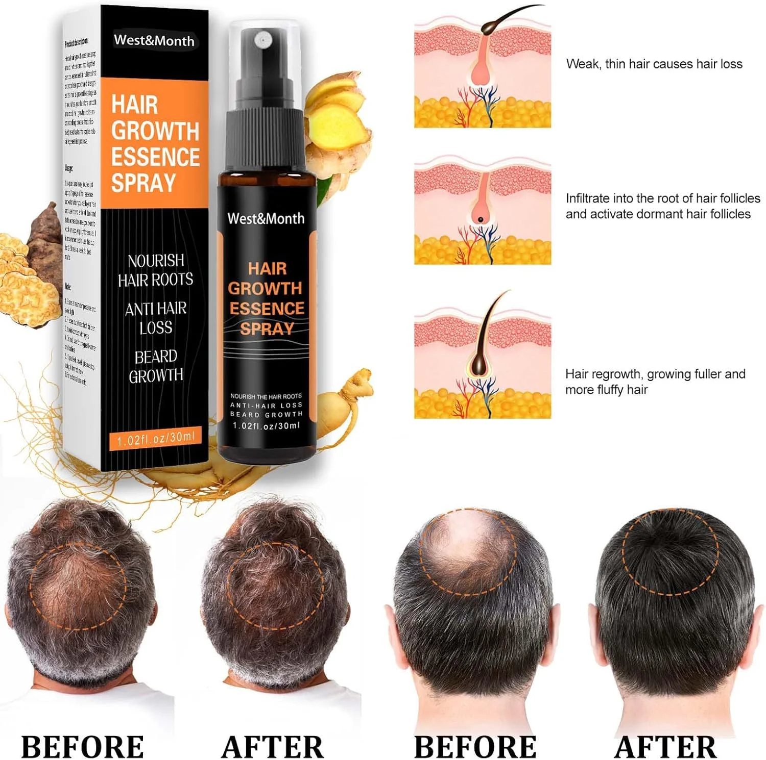 اسپری رشد مجدد مو - اسپری گیاهی معکوس کننده و تیره کننده موهای خاکستری، سرم رشد مو برای حجم بیشتر، درمان ضد ریزش مو برای مردان و زنان اسپری رشد مجدد مو - اسپری گیاهی معکوس کننده و تیره کننده موهای خاکستری، سرم رشد مو برای حجم بیشتر، درمان ضد ریزش مو برای مردان و زنان