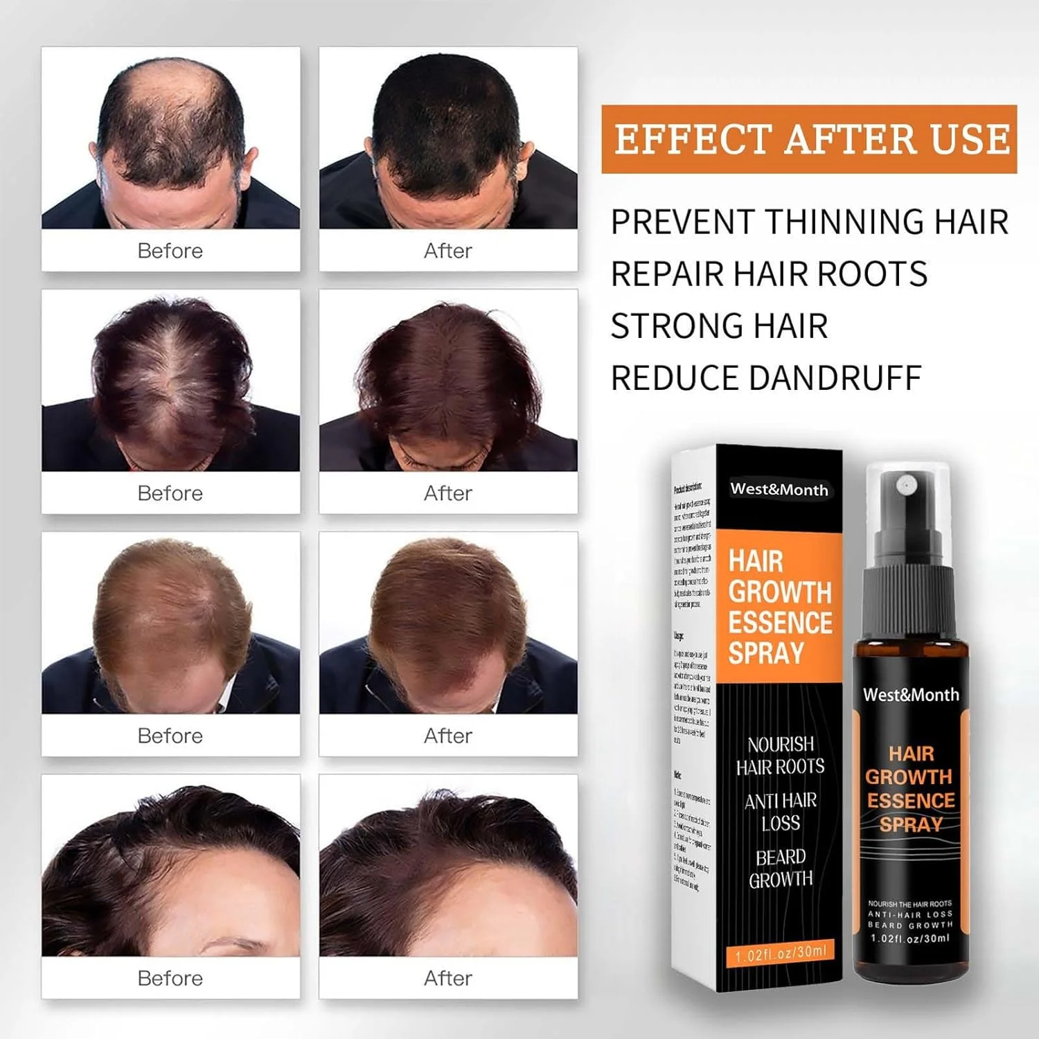 اسپری رشد مجدد مو - اسپری گیاهی معکوس کننده و تیره کننده موهای خاکستری، سرم رشد مو برای حجم بیشتر، درمان ضد ریزش مو برای مردان و زنان اسپری رشد مجدد مو - اسپری گیاهی معکوس کننده و تیره کننده موهای خاکستری، سرم رشد مو برای حجم بیشتر، درمان ضد ریزش مو برای مردان و زنان