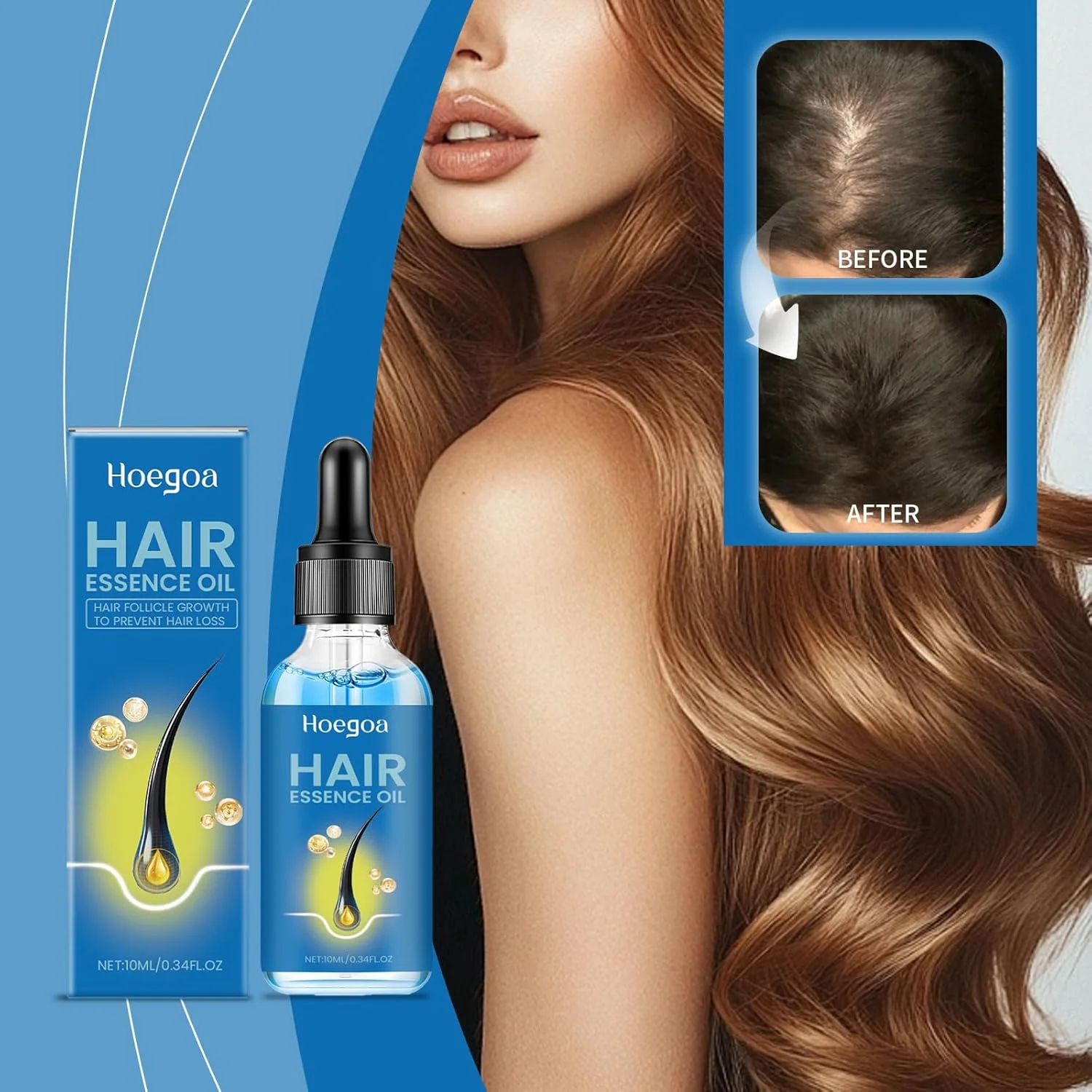 سرم رشد مو حاوی 5% ماینوکسیدیل با بیوتین و ویتامین H، محرک فولیکول های مو، متوقف کننده ریزش مو، تقویت کننده رشد مجدد، تقویت کننده ریشه مو، فرمول موضعی موثر برای آقایان و بانوان سرم رشد مو حاوی 5% ماینوکسیدیل با بیوتین و ویتامین H، محرک فولیکول های مو، متوقف کننده ریزش مو، تقویت کننده رشد مجدد، تقویت کننده ریشه مو، فرمول موضعی موثر برای آقایان و بانوان