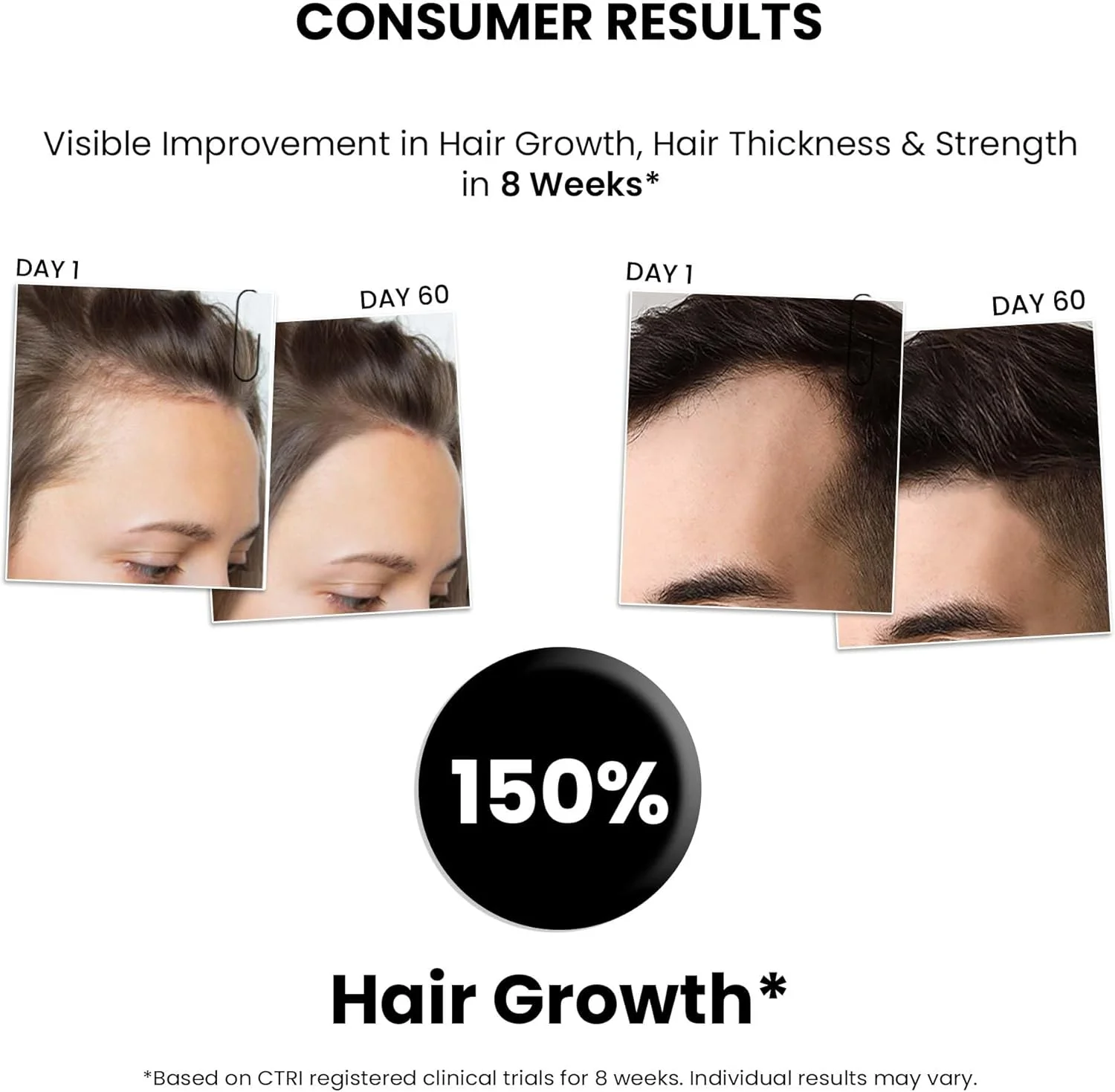 سرم رشد مو ThriveCo، 50 میلی لیتر، حاوی Redensyl، Anagain و Procapil (بسته 3 عددی) سرم رشد مو ThriveCo، 50 میلی لیتر، حاوی Redensyl، Anagain و Procapil (بسته 3 عددی)