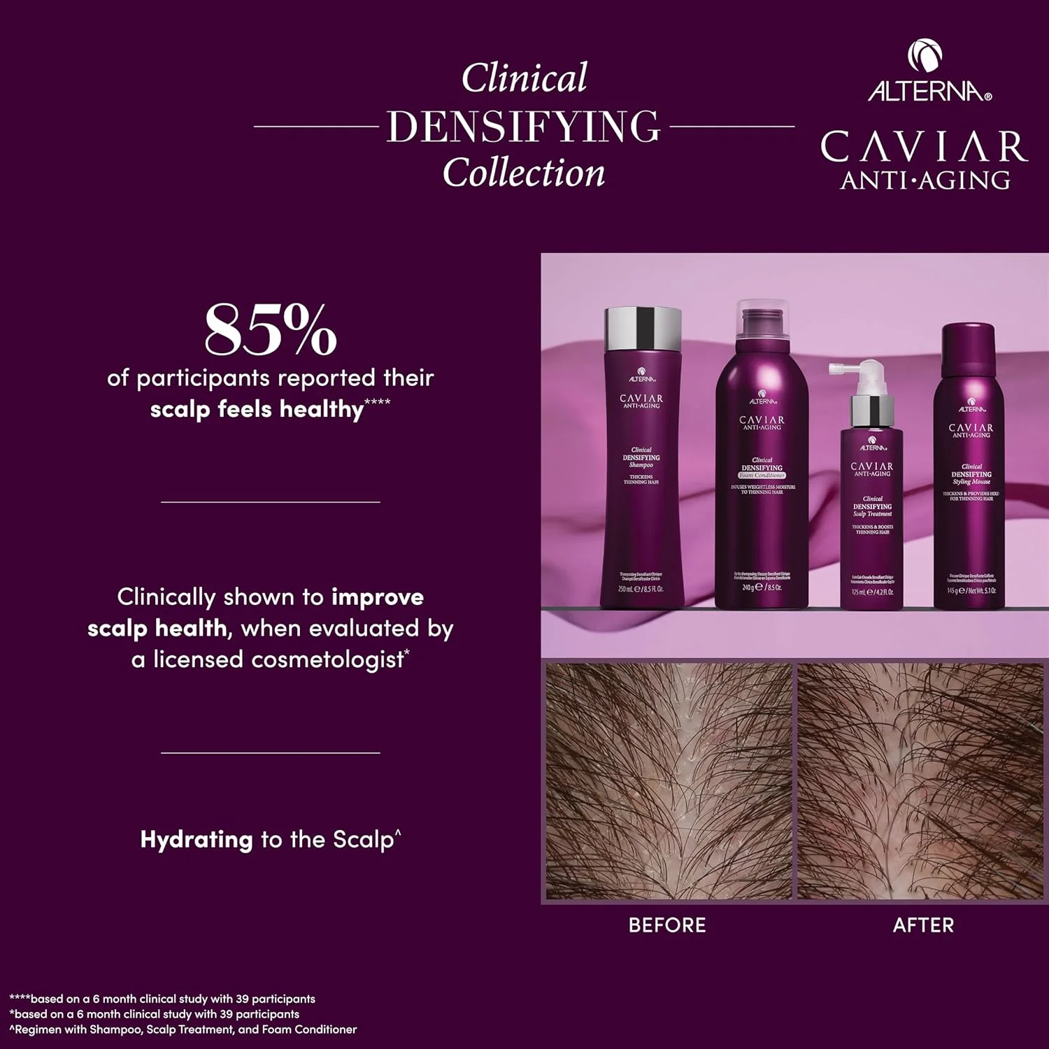 شامپو ضخیم کننده موهای نازک و کم پشت آلترنا CAVIAR Anti-Aging Clinical، حجم ۲۵۰ میلی لیتر | مناسب موهای نازک و کم پشت | ضخیم کننده مو و محافظت از پوست سر | فاقد سولفات شامپو ضخیم کننده موهای نازک و کم پشت آلترنا CAVIAR Anti-Aging Clinical، حجم ۲۵۰ میلی لیتر | مناسب موهای نازک و کم پشت | ضخیم کننده مو و محافظت از پوست سر | فاقد سولفات