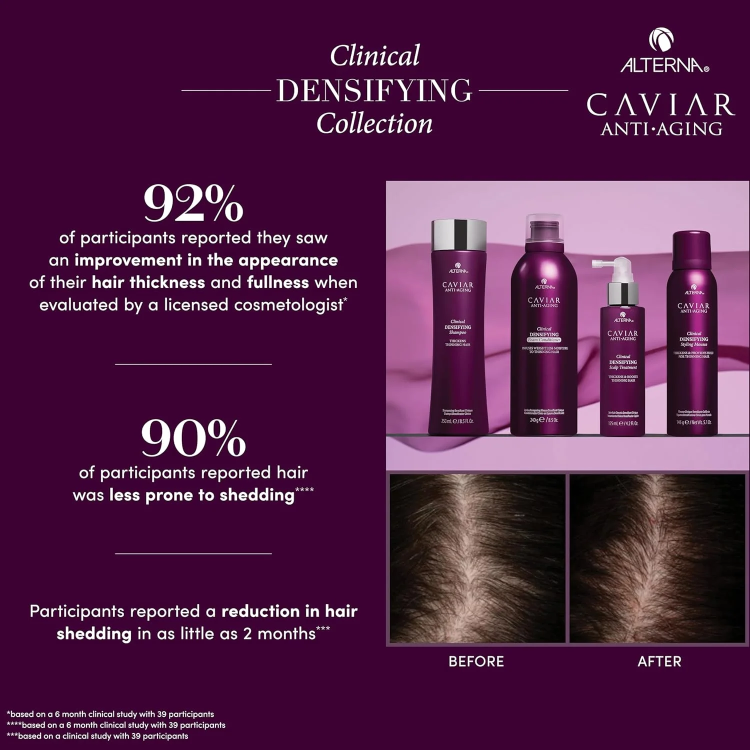 شامپو ضخیم کننده موهای نازک و کم پشت آلترنا CAVIAR Anti-Aging Clinical، حجم ۲۵۰ میلی لیتر | مناسب موهای نازک و کم پشت | ضخیم کننده مو و محافظت از پوست سر | فاقد سولفات شامپو ضخیم کننده موهای نازک و کم پشت آلترنا CAVIAR Anti-Aging Clinical، حجم ۲۵۰ میلی لیتر | مناسب موهای نازک و کم پشت | ضخیم کننده مو و محافظت از پوست سر | فاقد سولفات