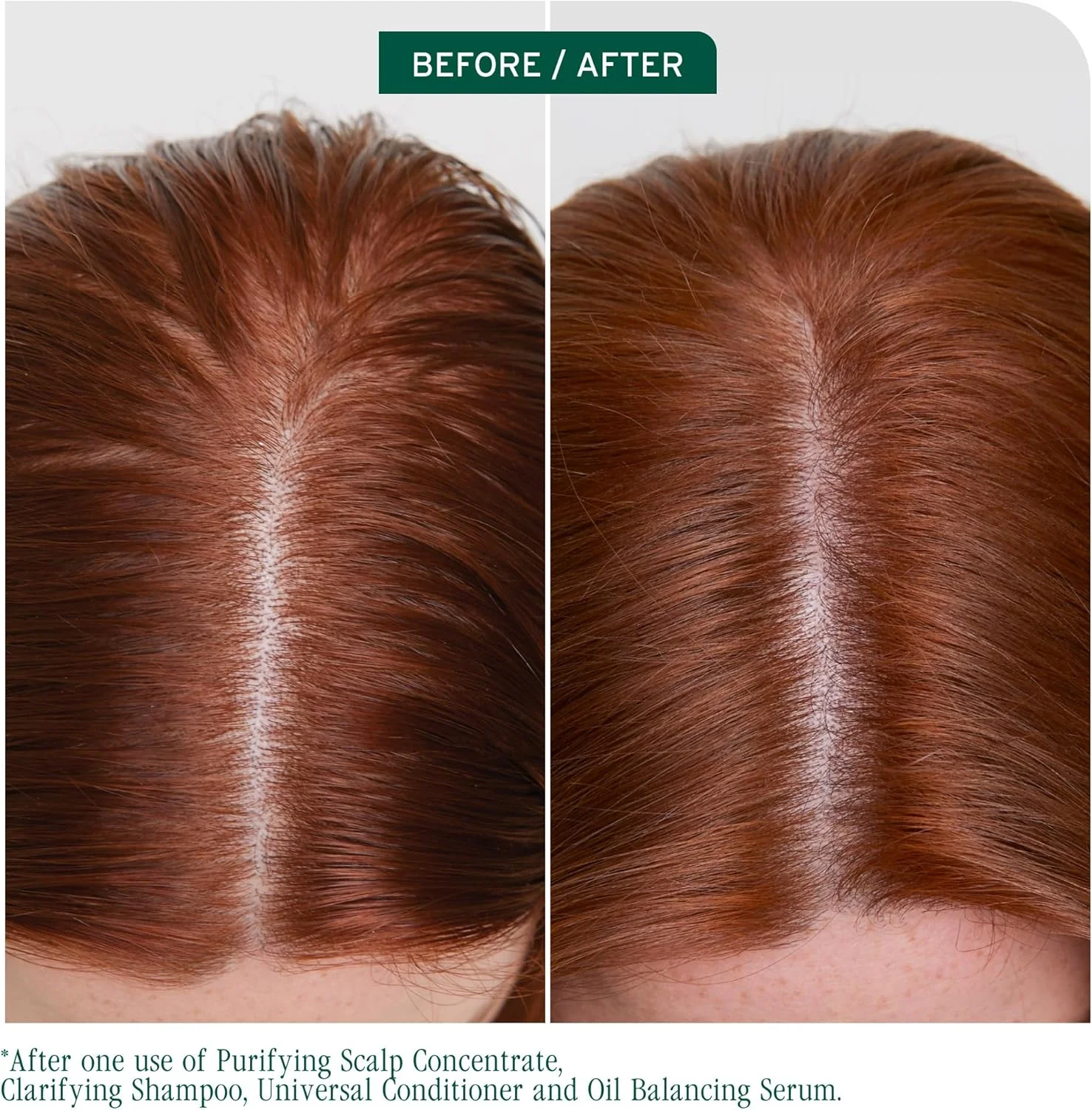 شامپو پاک کننده Biolage Scalp Sync - از بین برنده رسوبات و تجمع چربی، برای پوست سر چرب، حاوی چای تخمیر شده و اسید گلیکولیک، وگان و بدون پارابن، 400 میلی لیتر، بسته بندی ممکن است متفاوت باشد
