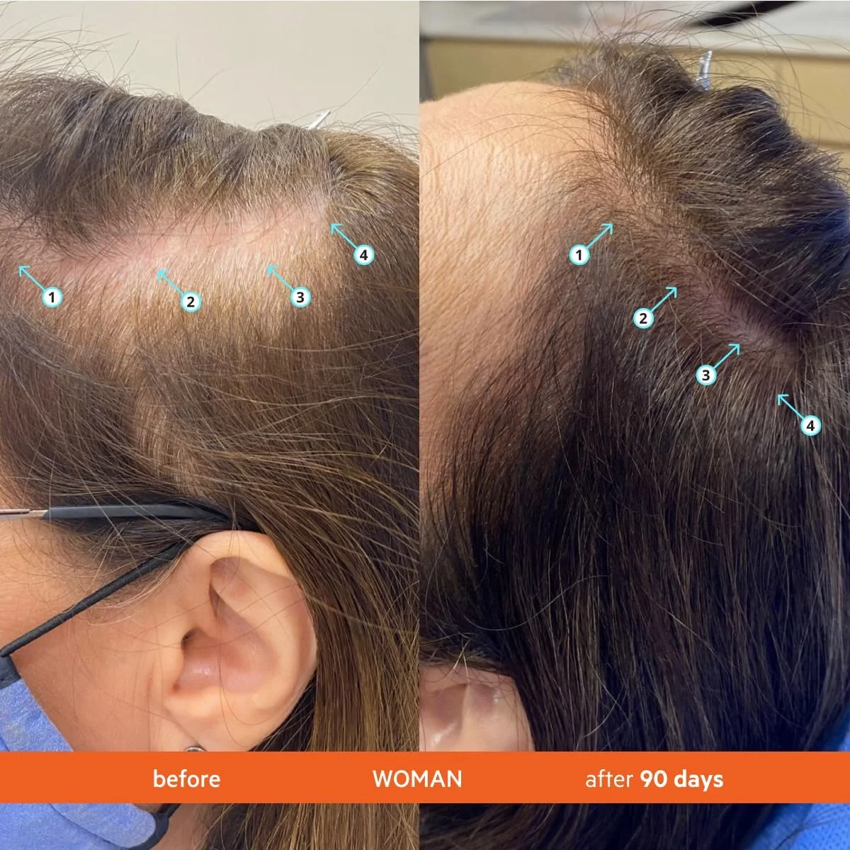 شامپو رویتای DS Labs، 205 میلی لیتر - افزایش ضخامت ظاهری مو، پاک کننده اولیه پوست سر، موهایی با ظاهر پرتر، حجم دهنده، آبرسانی سبک، بدون سولفات و سیلیکون، ایمن برای موهای رنگ شده، برای آقایان و بانوان شامپو رویتای DS Labs، 205 میلی لیتر - افزایش ضخامت ظاهری مو، پاک کننده اولیه پوست سر، موهایی با ظاهر پرتر، حجم دهنده، آبرسانی سبک، بدون سولفات و سیلیکون، ایمن برای موهای رنگ شده، برای آقایان و بانوان