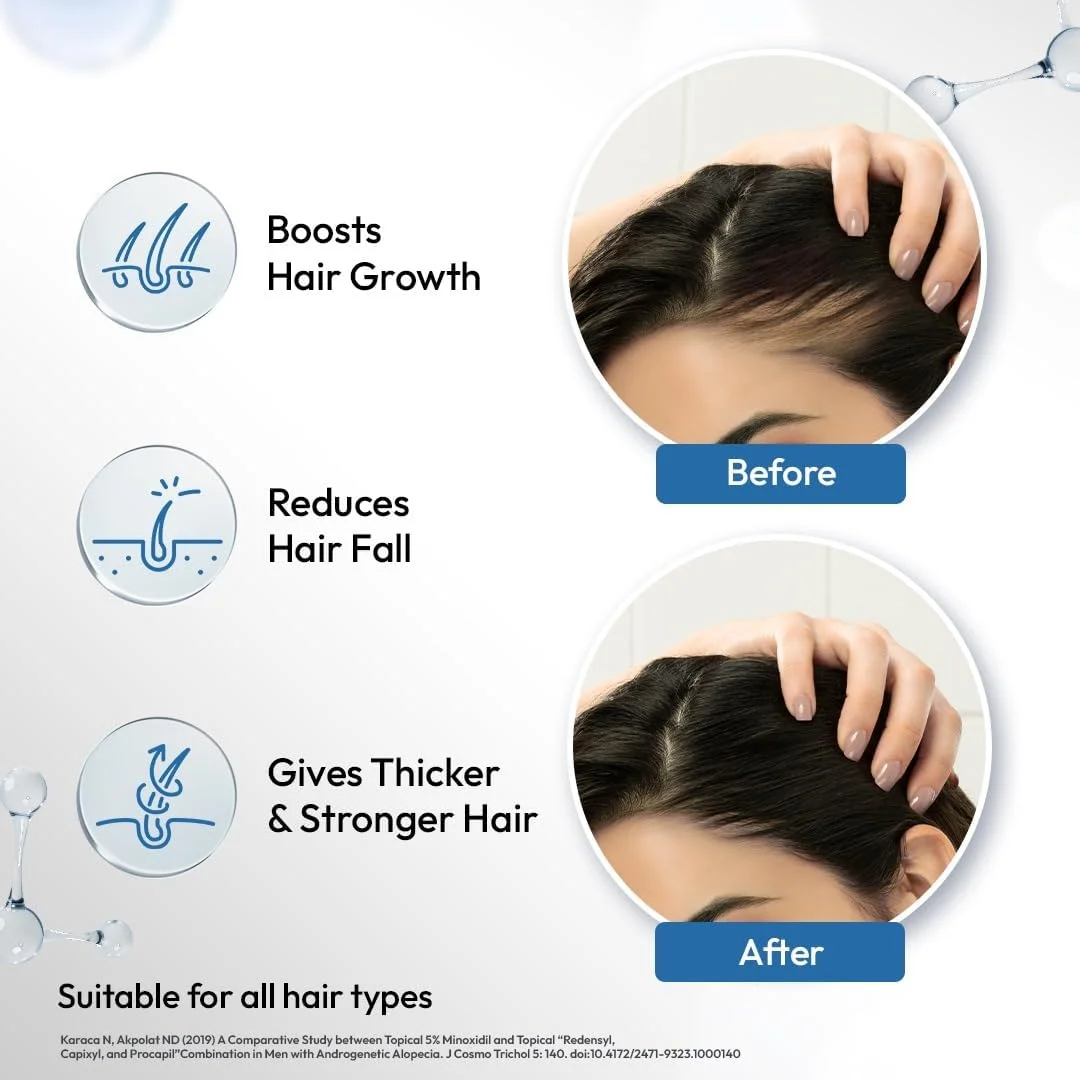 سرم رشد مو Scalpe Pro به همراه اپلیکاتور | 3% Redensyl، 4% Capixyl، 3% Procapil، 3% Anagain | تقویت کننده رشد مو | موهای ضخیم تر و قوی تر | غیر چسبنده | فاقد پارابن و سولفات | مناسب برای آقایان و بانوان | 30 میلی لیتر سرم رشد مو Scalpe Pro به همراه اپلیکاتور | 3% Redensyl، 4% Capixyl، 3% Procapil، 3% Anagain | تقویت کننده رشد مو | موهای ضخیم تر و قوی تر | غیر چسبنده | فاقد پارابن و سولفات | مناسب برای آقایان و بانوان | 30 میلی لیتر