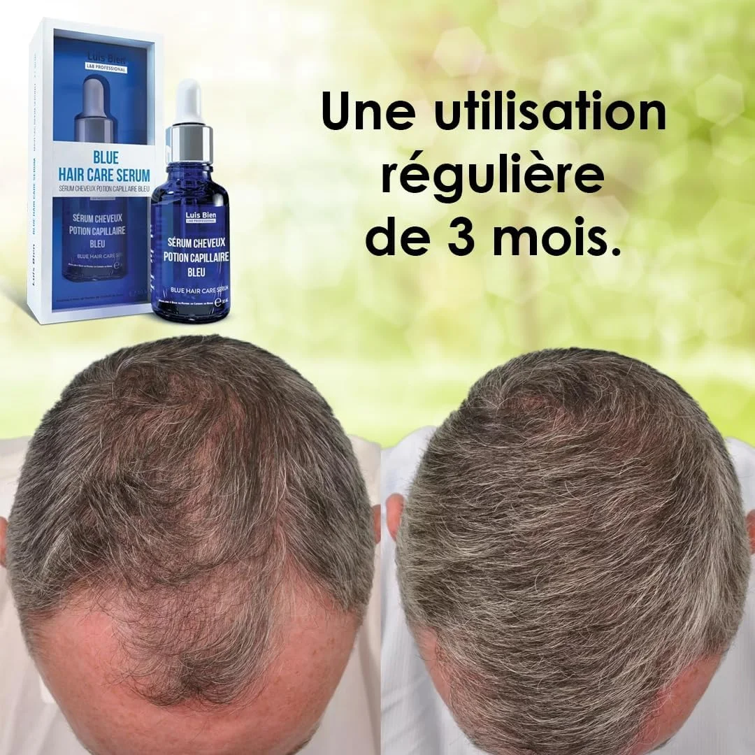 کیت سرم رشد مو آبی لوئیس بین به همراه درمارولر، درمان ریزش مو برای آقایان و بانوان، روغن ریزش مو برای ضخیم شدن مو، کیت ریزش مو و رشد مجدد - سرم 30 میلی لیتر + درمارولر تیتانیومی 0.5 سوزنی کیت سرم رشد مو آبی لوئیس بین به همراه درمارولر، درمان ریزش مو برای آقایان و بانوان، روغن ریزش مو برای ضخیم شدن مو، کیت ریزش مو و رشد مجدد - سرم 30 میلی لیتر + درمارولر تیتانیومی 0.5 سوزنی