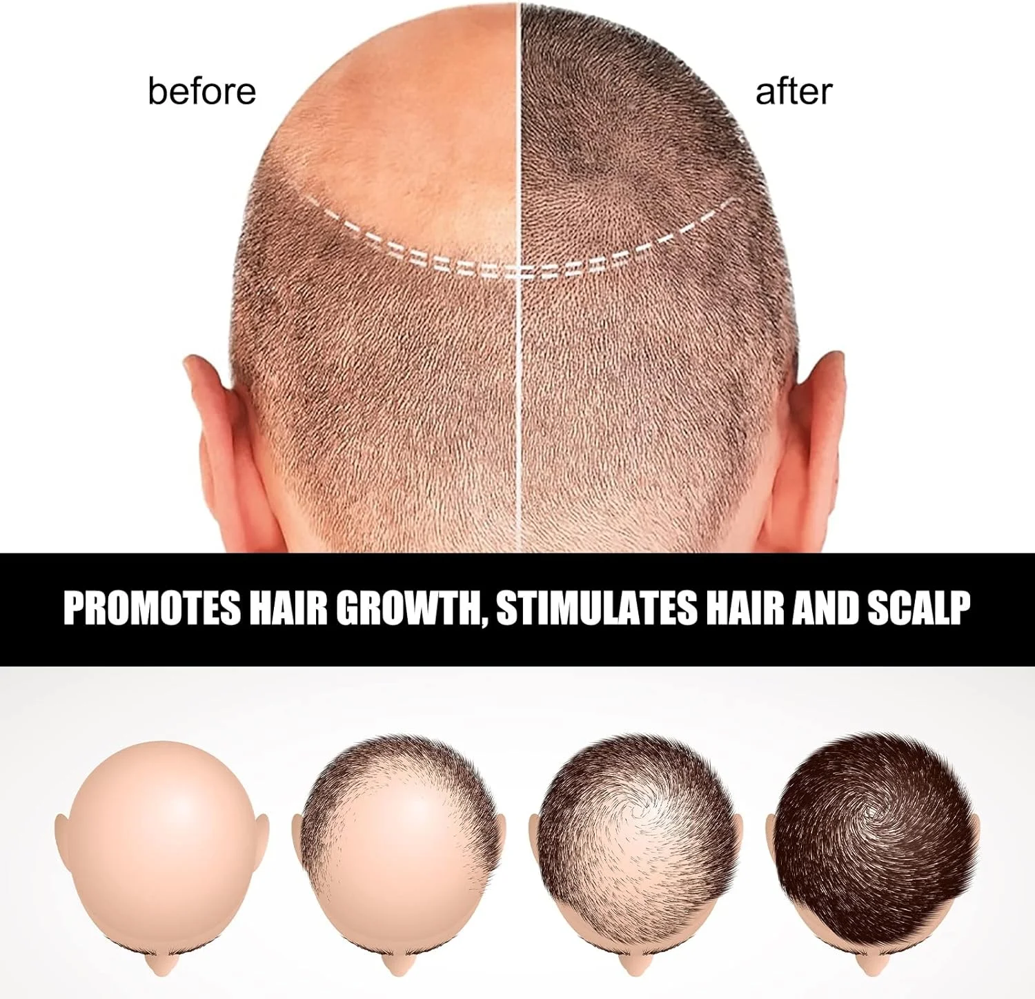 لوسیون سرم آمپول رشد مو NLLNT، آمپول های درمان سرم ضد ریزش مو، درمان سرم احیا کننده مو 5 عدد/مجموعه