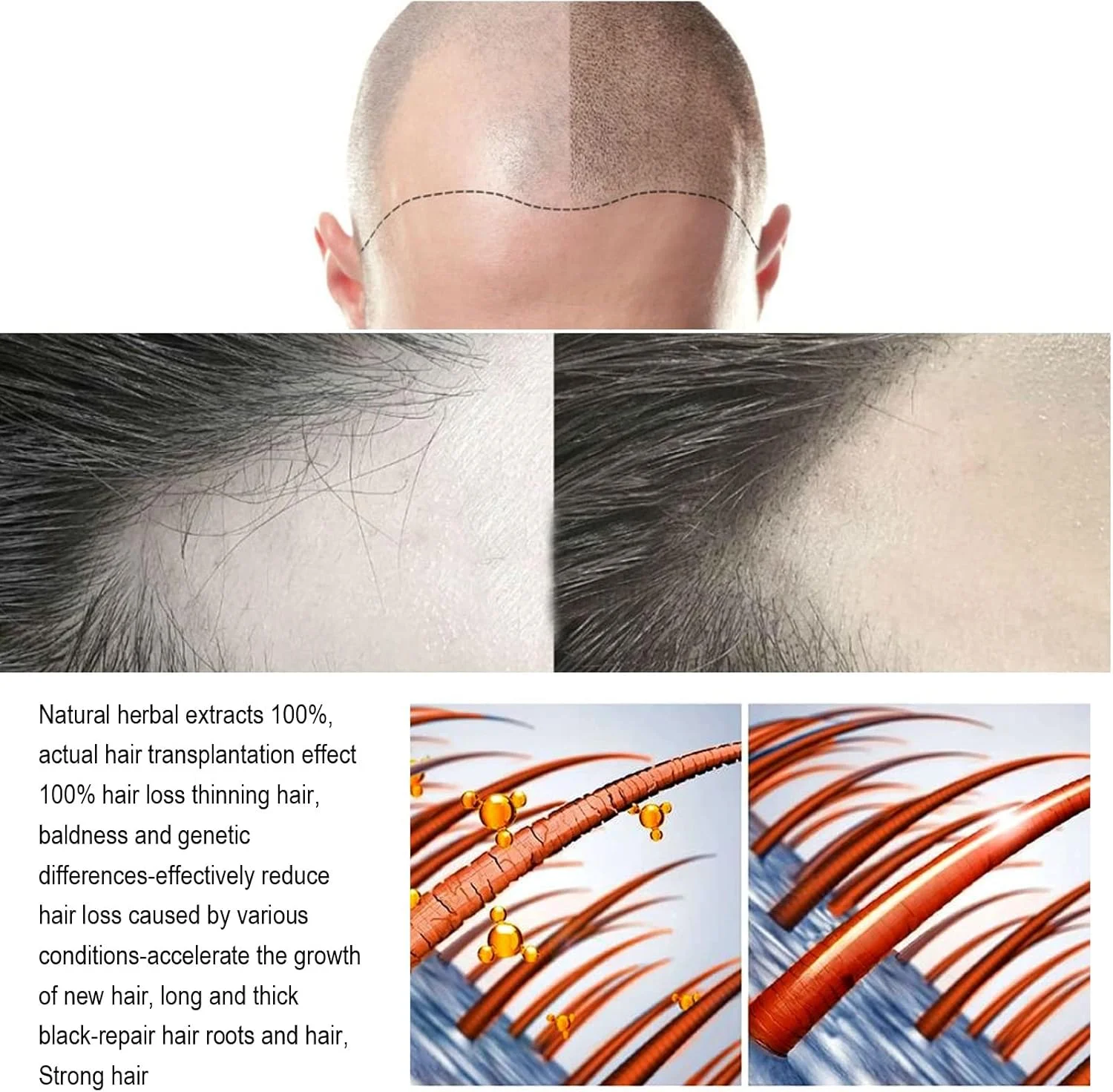 اسپری زنجبیل مغذی و تقویت کننده مو گرین پوینت، 3 عددی، برای افزایش حجم ریشه و تقویت مو - 120 میلی لیتر اسپری زنجبیل مغذی و تقویت کننده مو گرین پوینت، 3 عددی، برای افزایش حجم ریشه و تقویت مو - 120 میلی لیتر