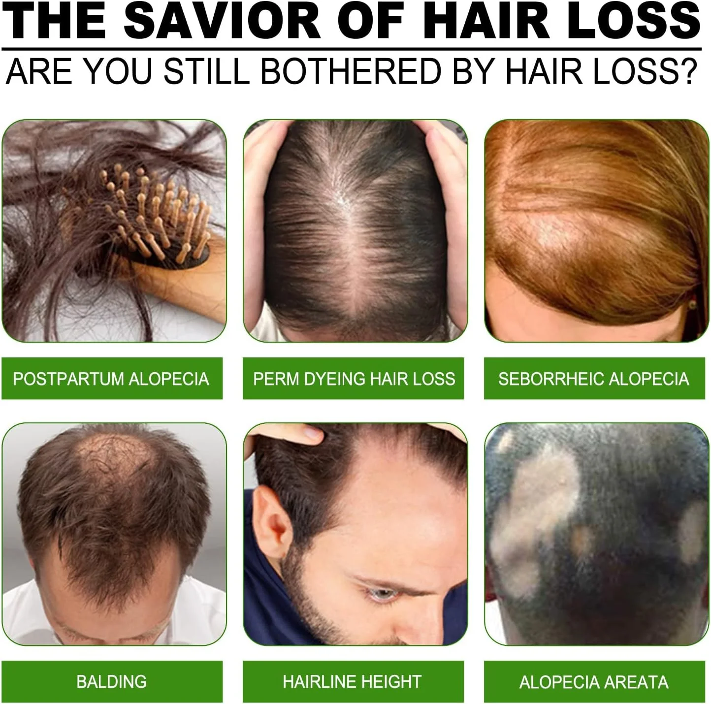 اسپری زنجبیل مغذی و تقویت کننده مو گرین پوینت، 3 عددی، برای افزایش حجم ریشه و تقویت مو - 120 میلی لیتر اسپری زنجبیل مغذی و تقویت کننده مو گرین پوینت، 3 عددی، برای افزایش حجم ریشه و تقویت مو - 120 میلی لیتر