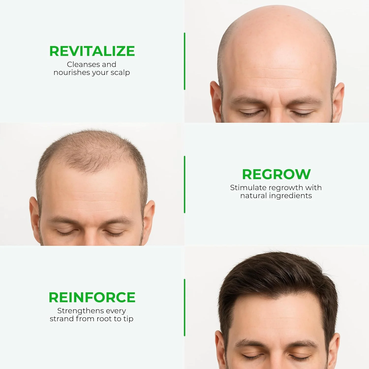 لوسیون موی گرین ولث نئو برای درمان ریزش مو | رشد مجدد مو | نازک شدن، لکه های طاسی و ریزش مو | فرمول مورد اعتماد با جینسینگ، نخل اره ای و دم اسب | 120 میلی لیتر لوسیون موی گرین ولث نئو برای درمان ریزش مو | رشد مجدد مو | نازک شدن، لکه های طاسی و ریزش مو | فرمول مورد اعتماد با جینسینگ، نخل اره ای و دم اسب | 120 میلی لیتر