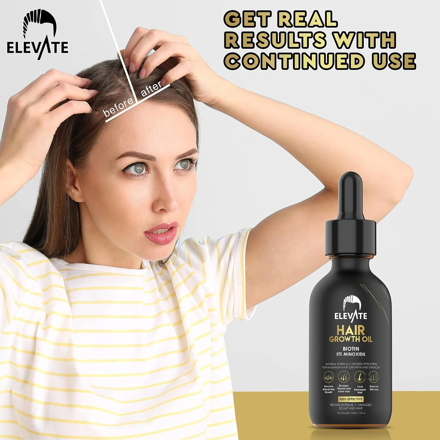 روغن تقویت کننده مو ELEVATE - سرم بیوتین و درمان 5% ماینوکسیدیل برای موهای قوی تر، ضخیم تر و بلندتر - درمان طبیعی ضخیم کننده - توقف نازک شدن و ریزش مو برای مردان و زنان 30ml روغن تقویت کننده مو ELEVATE - سرم بیوتین و درمان 5% ماینوکسیدیل برای موهای قوی تر، ضخیم تر و بلندتر - درمان طبیعی ضخیم کننده - توقف نازک شدن و ریزش مو برای مردان و زنان 30ml