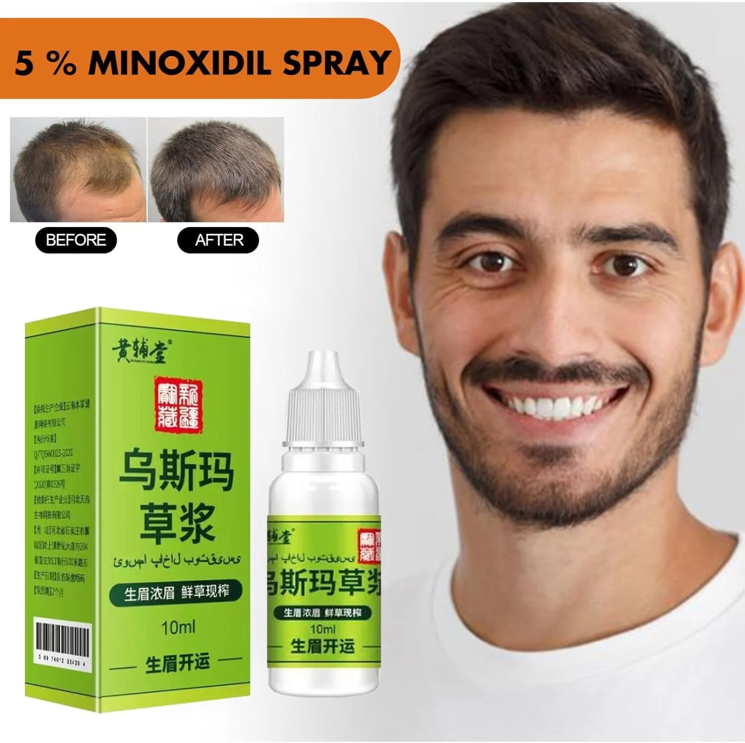 لوسیون مو گیاهی اورسا - سرم مغذی رشد مو گیاهی خالص اورسا، مراقبت از مژه و مراقبت از مو، سرم رشد سریع مو با عصاره گیاه اورسا، رشد مو در مدت کوتاه 10 میلی لیتر (2 عدد) لوسیون مو گیاهی اورسا - سرم مغذی رشد مو گیاهی خالص اورسا، مراقبت از مژه و مراقبت از مو، سرم رشد سریع مو با عصاره گیاه اورسا، رشد مو در مدت کوتاه 10 میلی لیتر (2 عدد)