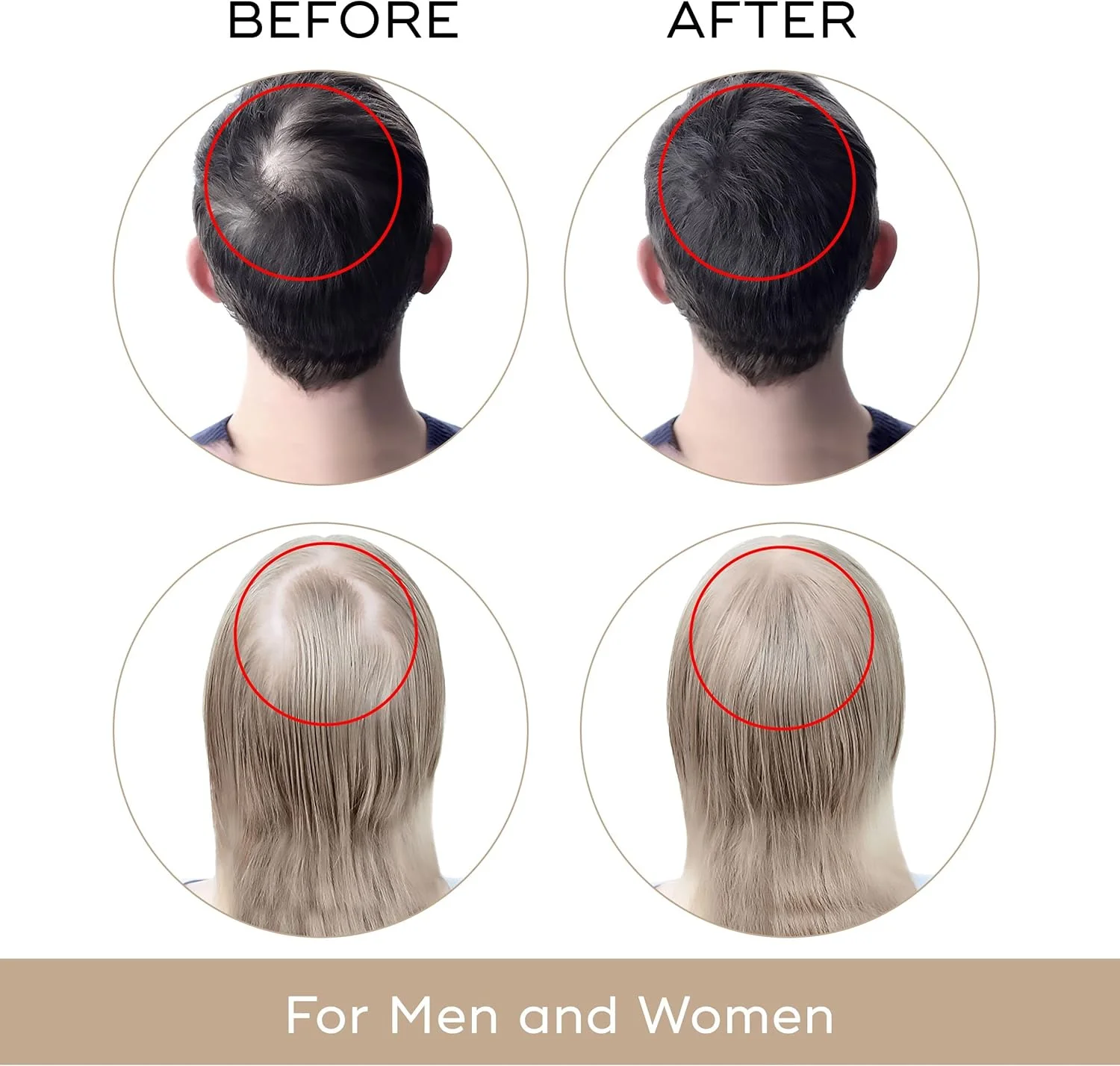 سرم رشد مجدد مو دکوهیر آمریکا - متوقف کننده نازک شدن مو، تقویت کننده رشد و افزایش دهنده حجم ریشه