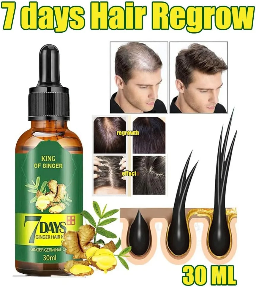 TSSPLUS [موجود در انبار آمریکا] بسته 3 عددی سرم رشد مو 7 روزه با زنجبیل، روغن رشد سریع، اسانس درمان ضد ریزش
