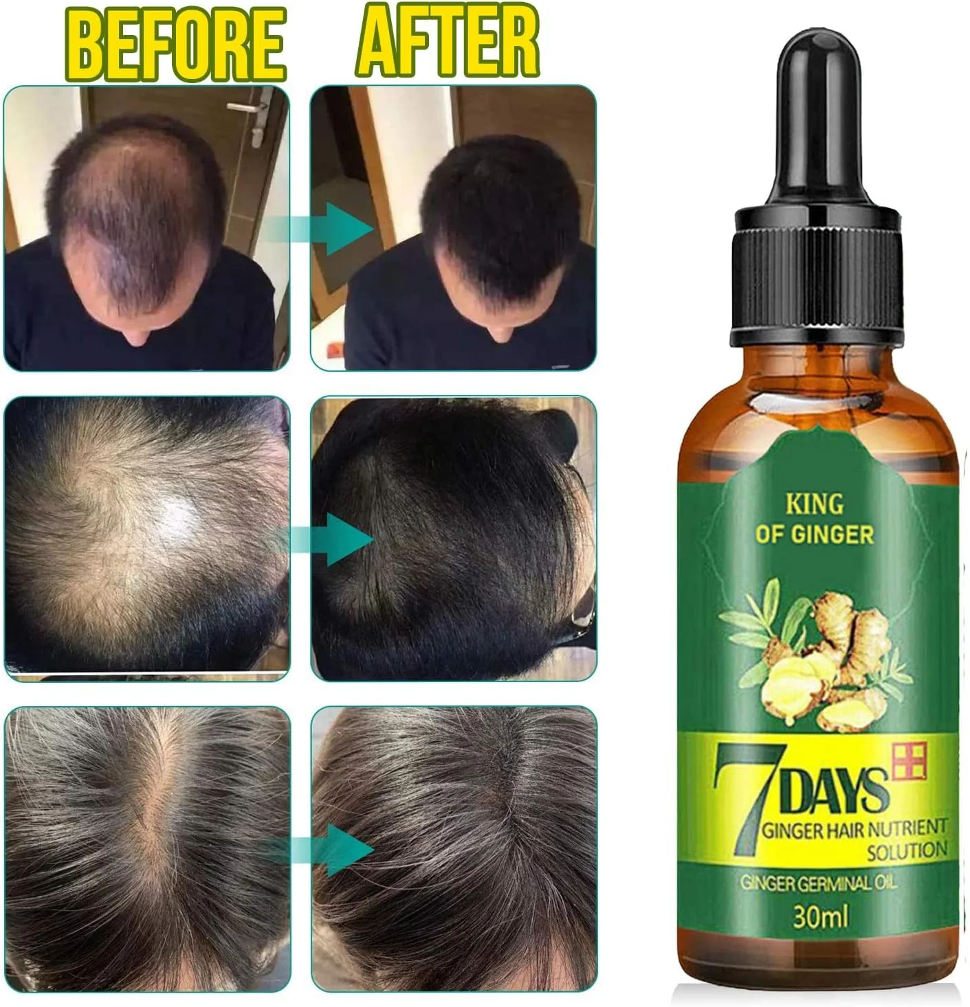 TSSPLUS [موجود در انبار آمریکا] بسته 3 عددی سرم رشد مو 7 روزه با زنجبیل، روغن رشد سریع، اسانس درمان ضد ریزش