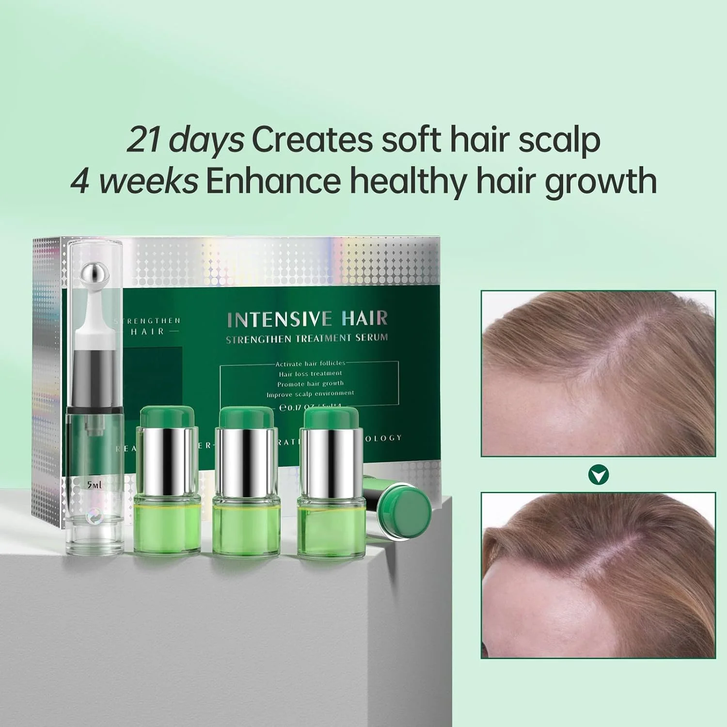 سرم رشد مو، درمان رشد مو NLLNT، ضد ریزش مو، تقویت کننده موهای ضخیم تر و قوی تر، و روغن رشد مجدد مو برای مردان و زنان، فناوری خلاقانه جداسازی آب و روغن 4X5ml