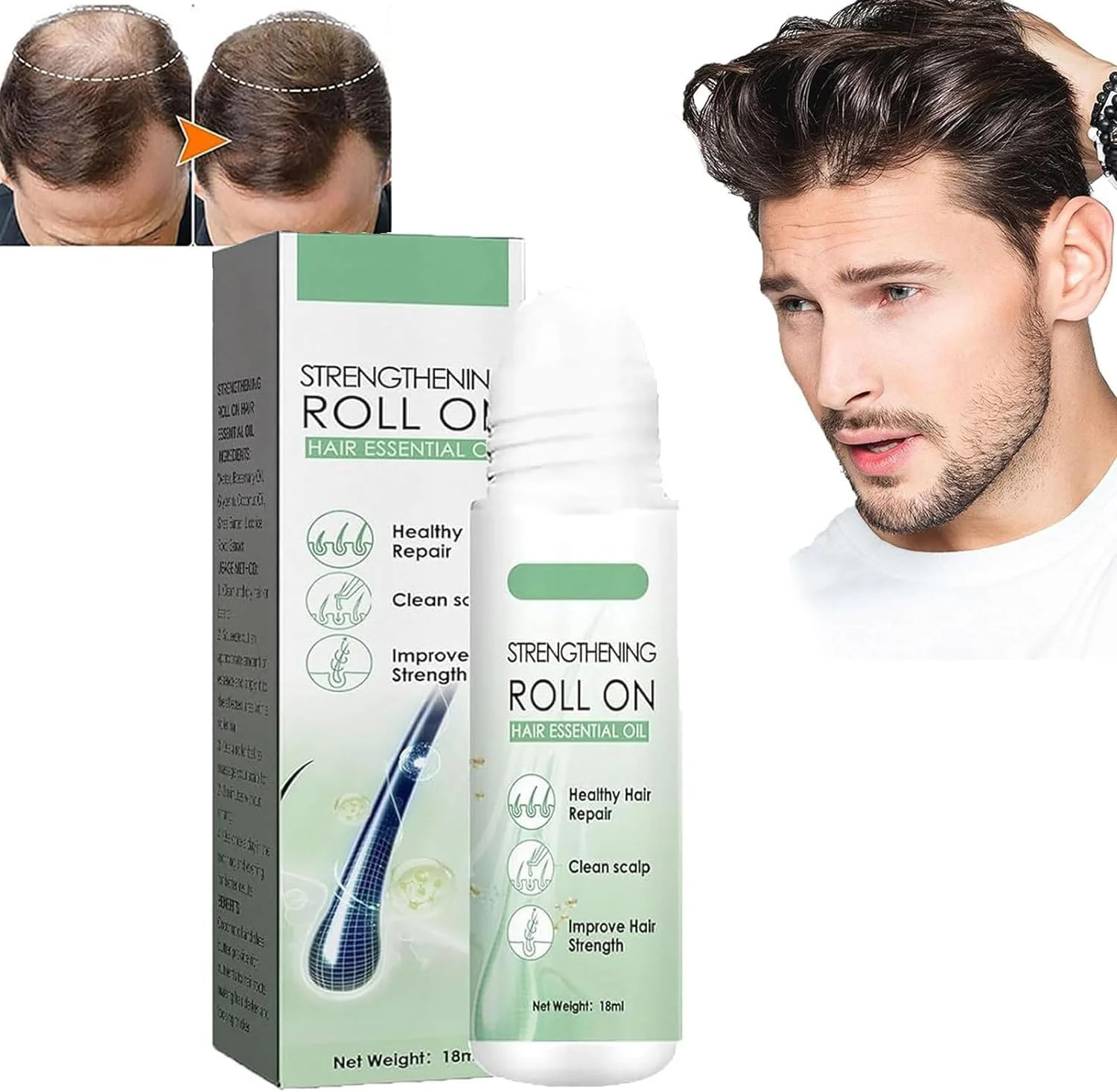 درمان مو با رول-آن Renew Hair X، روغن ضروری ضخیم کننده مو Renewhair X Roller، سرم رولی رشد مو Hairgrowth-X، رویش مجدد مو و ریش Renewhairx، پایان دادن به ریزش مو برای مردان و زنان (1 عدد) درمان مو با رول-آن Renew Hair X، روغن ضروری ضخیم کننده مو Renewhair X Roller، سرم رولی رشد مو Hairgrowth-X، رویش مجدد مو و ریش Renewhairx، پایان دادن به ریزش مو برای مردان و زنان (1 عدد)