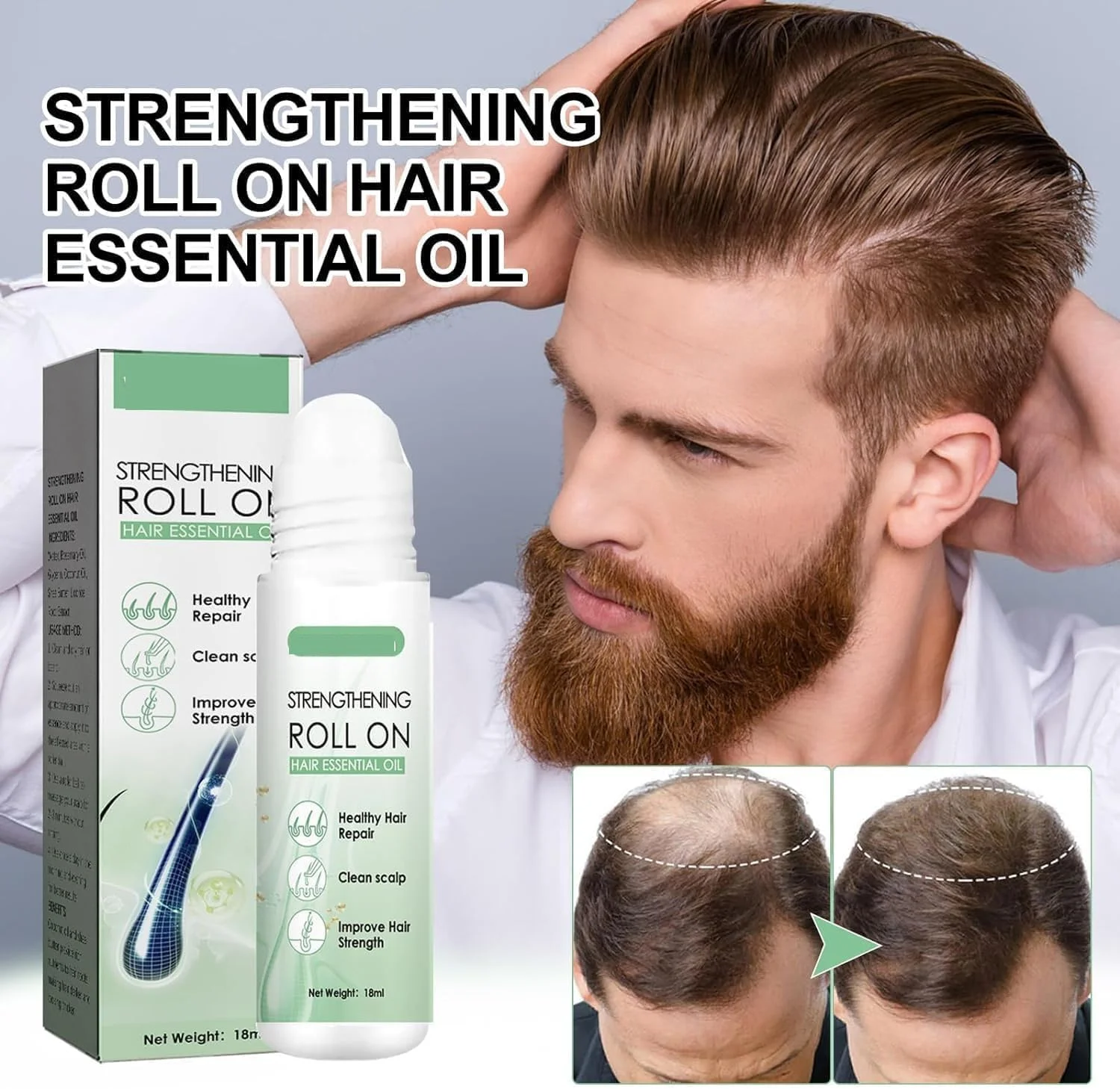 درمان مو با رول-آن Renew Hair X، روغن ضروری ضخیم کننده مو Renewhair X Roller، سرم رولی رشد مو Hairgrowth-X، رویش مجدد مو و ریش Renewhairx، پایان دادن به ریزش مو برای مردان و زنان (1 عدد)