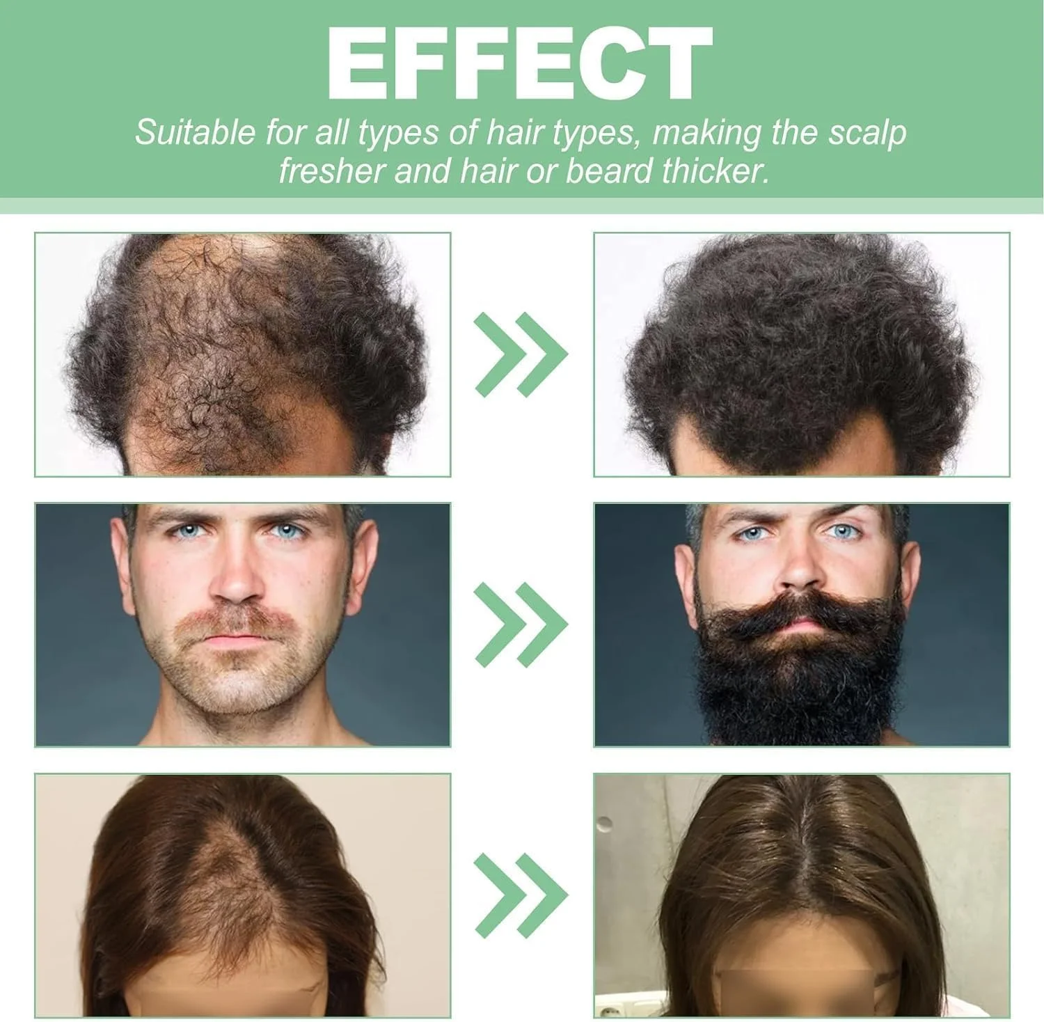 درمان مو با رول-آن Renew Hair X، روغن ضروری ضخیم کننده مو Renewhair X Roller، سرم رولی رشد مو Hairgrowth-X، رویش مجدد مو و ریش Renewhairx، پایان دادن به ریزش مو برای مردان و زنان (1 عدد)