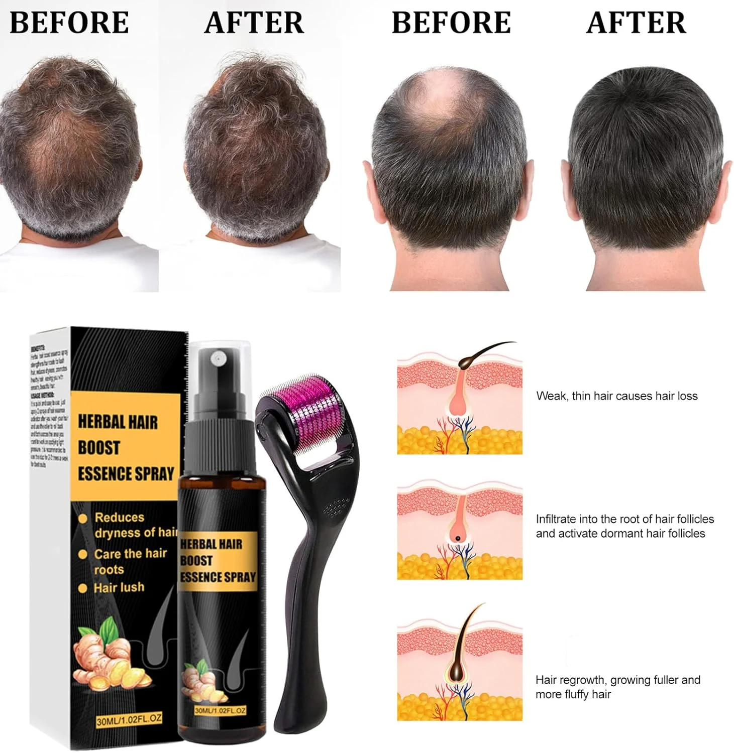 تک کروه کیت درمان پیشرفته رشد مجدد مو 30 میلی لیتر، اسپری رشد مو، ست غلتکی و اسانس رشد مجدد مو، ضد ریزش مو، محرک رشد موهای جدید، سرم