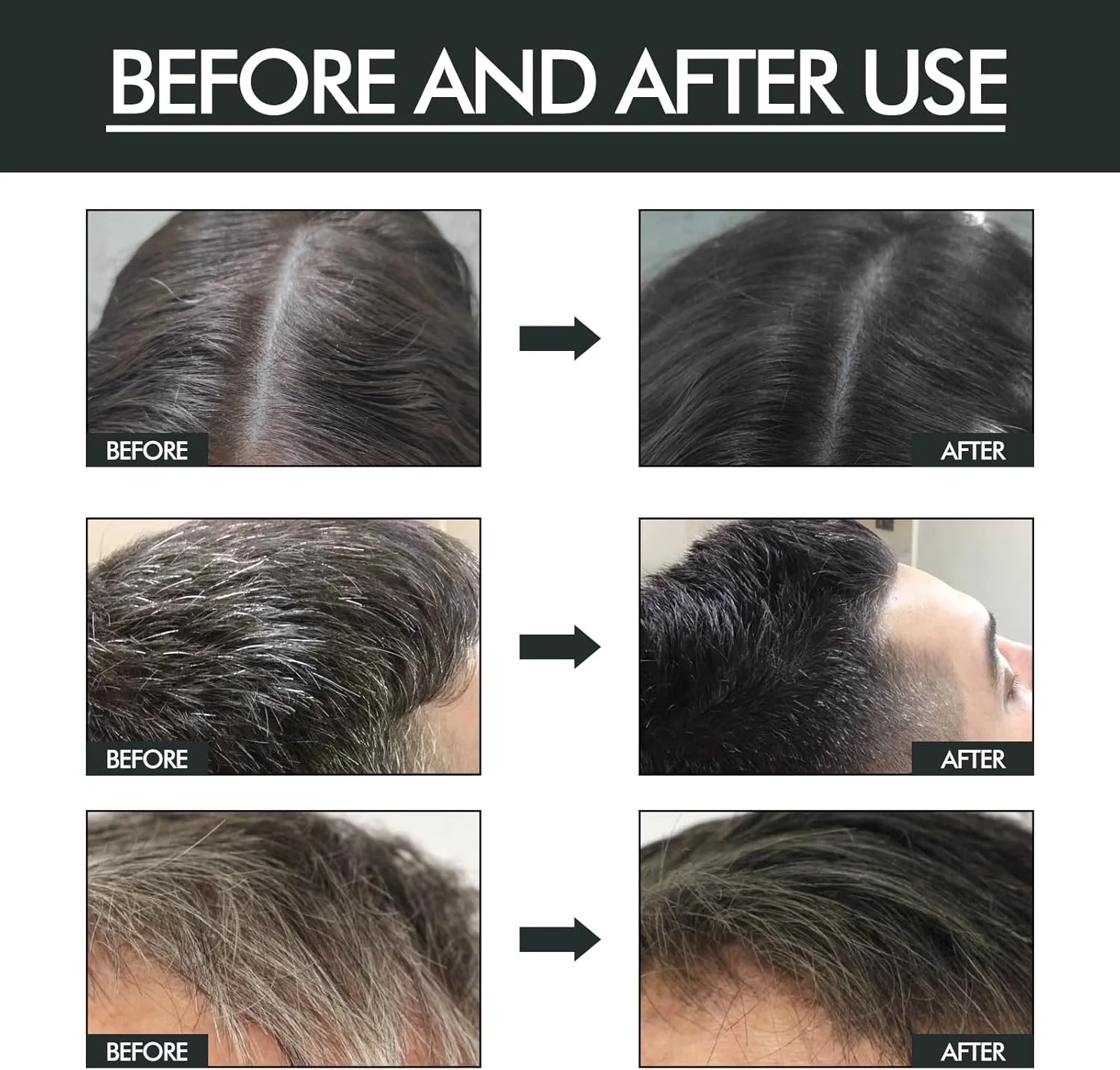 اسپری رنگ مو مشکی تکروح 100 میلی لیتر، اسپری رنگ مو مشکی، اسپری رشد مو، اسپری رنگ مو موقت برای زنان و مردان، پوشش موهای سفید، تغذیه و تقویت ریشه مو، سرم مو