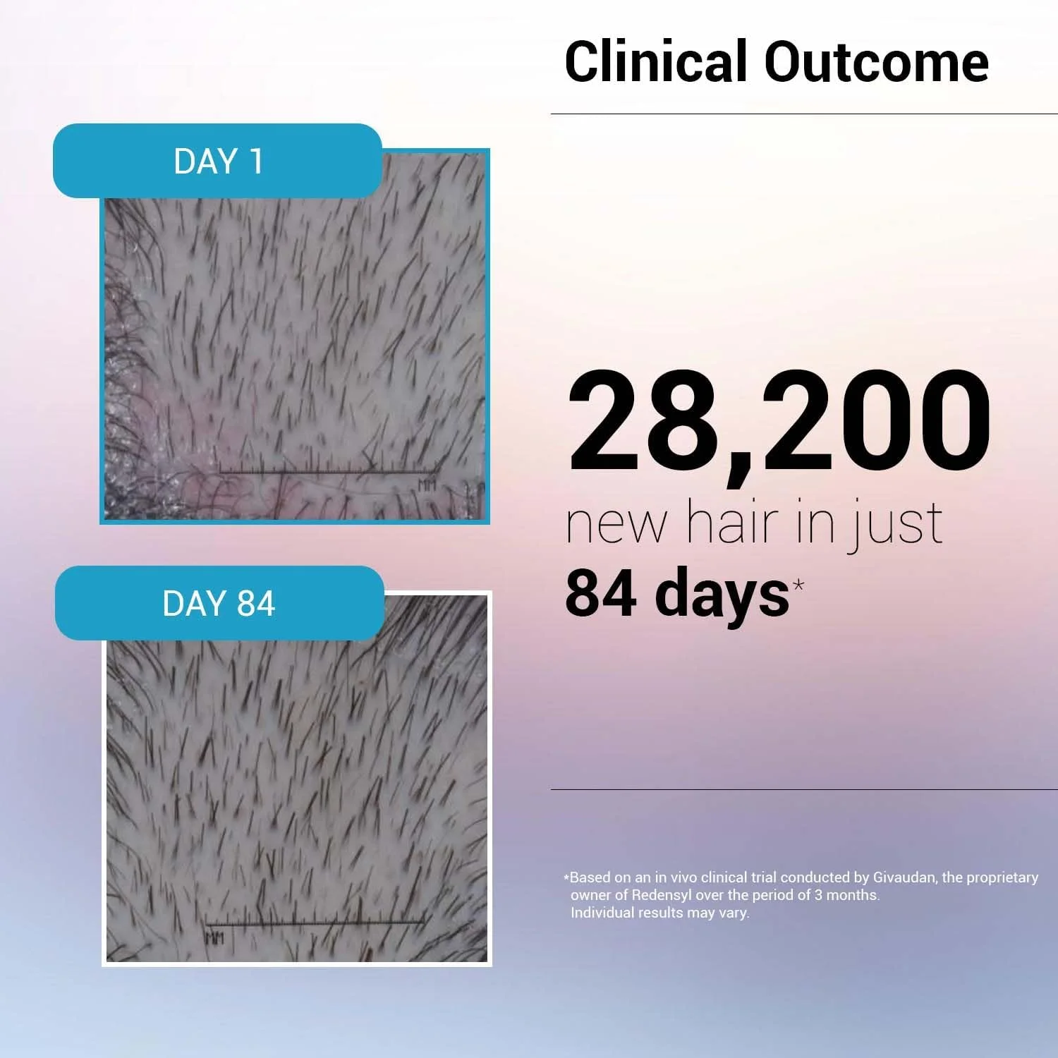 سرم رشد مو Sotrue با 3% Redensyl - 2 برابر نتایج بهتر از ماینوکسیدیل | 3% Procapil، 4% Anagain و 2% Baicapil | مواد فعال رشد مو، کنترل ریزش مو برای زنان و مردان، برای انواع مو، 30 میلی لیتر