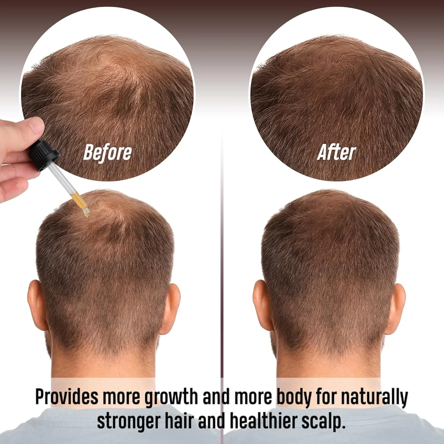 سرم مراقبت از مو رپلکسیون برای آقایان و بانوان، سرم مغذی، تقویت کننده و احیا کننده برای موهای آسیب دیده و ریزش دار، فاکتور رشد (4 بطری - 120 میلی لیتر)