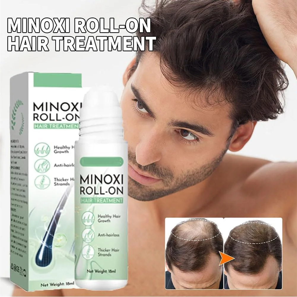 Renewhairx - درمان موی رولی Renew Hair X، رویش مجدد مو و ریش Renew Hair X، سرم رشد مو Renewhair-X (4 عدد)