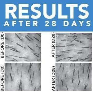 سرم رشد مو و درمان ضد ریزش مو REKZE 24 با فرمولاسیون بالینی برای مردان و زنان، برای موهای نازک، ضخیم کننده و رشد مجدد، مسدود کننده قوی DHT، تامین 3 ماهه سرم رشد مو و درمان ضد ریزش مو REKZE 24 با فرمولاسیون بالینی برای مردان و زنان، برای موهای نازک، ضخیم کننده و رشد مجدد، مسدود کننده قوی DHT، تامین 3 ماهه