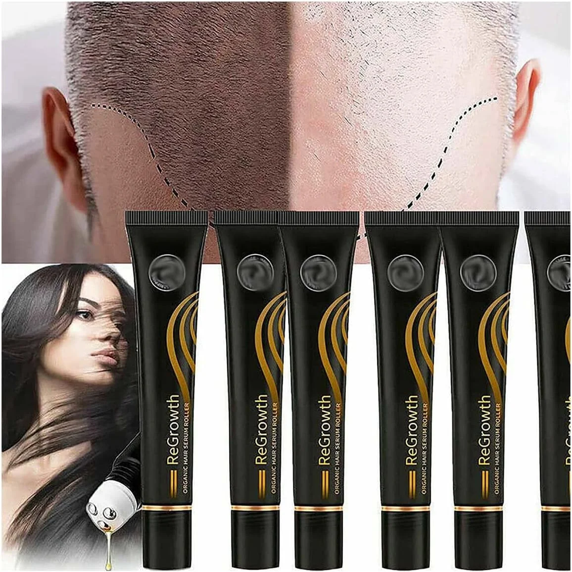 مجموعه سرم غلتکی ارگانیک رویش مجدد مو، مراقبت از مو، مایع ضد ریزش (1 عدد)